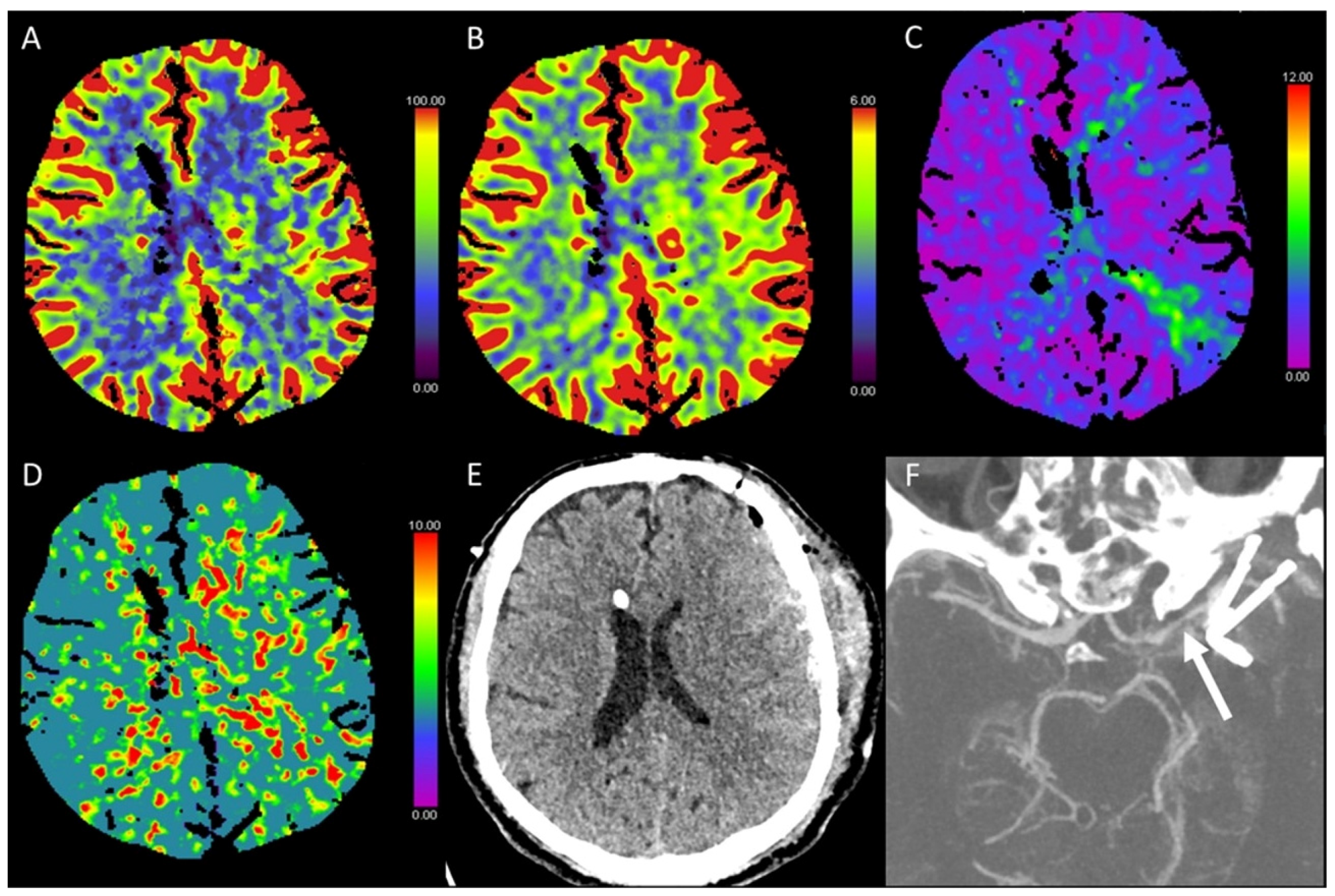 Diagnostics 13 00447 g011 Diagnostics 13 00447 g011