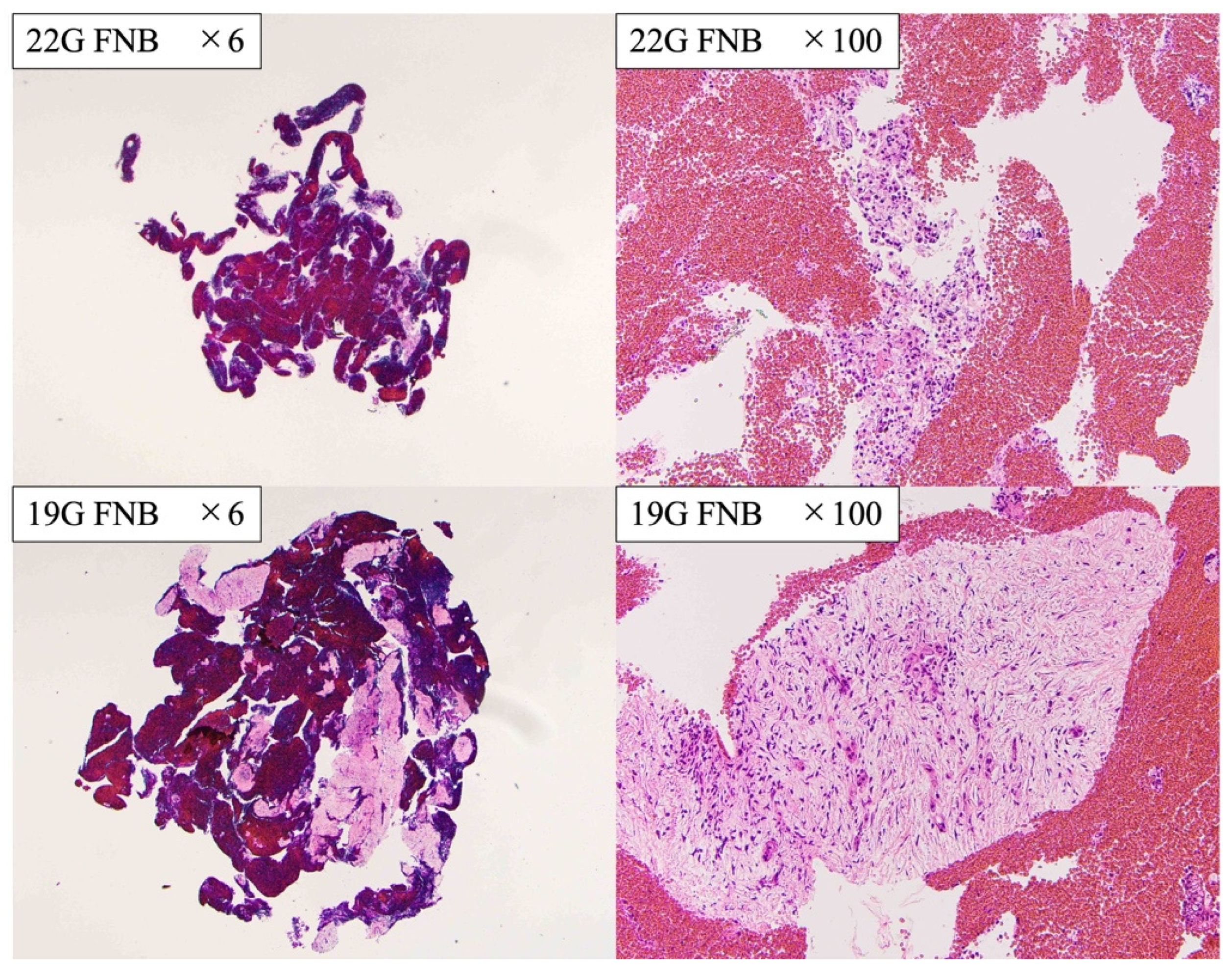 Diagnostics 13 00450 g004 Diagnostics 13 00450 g004