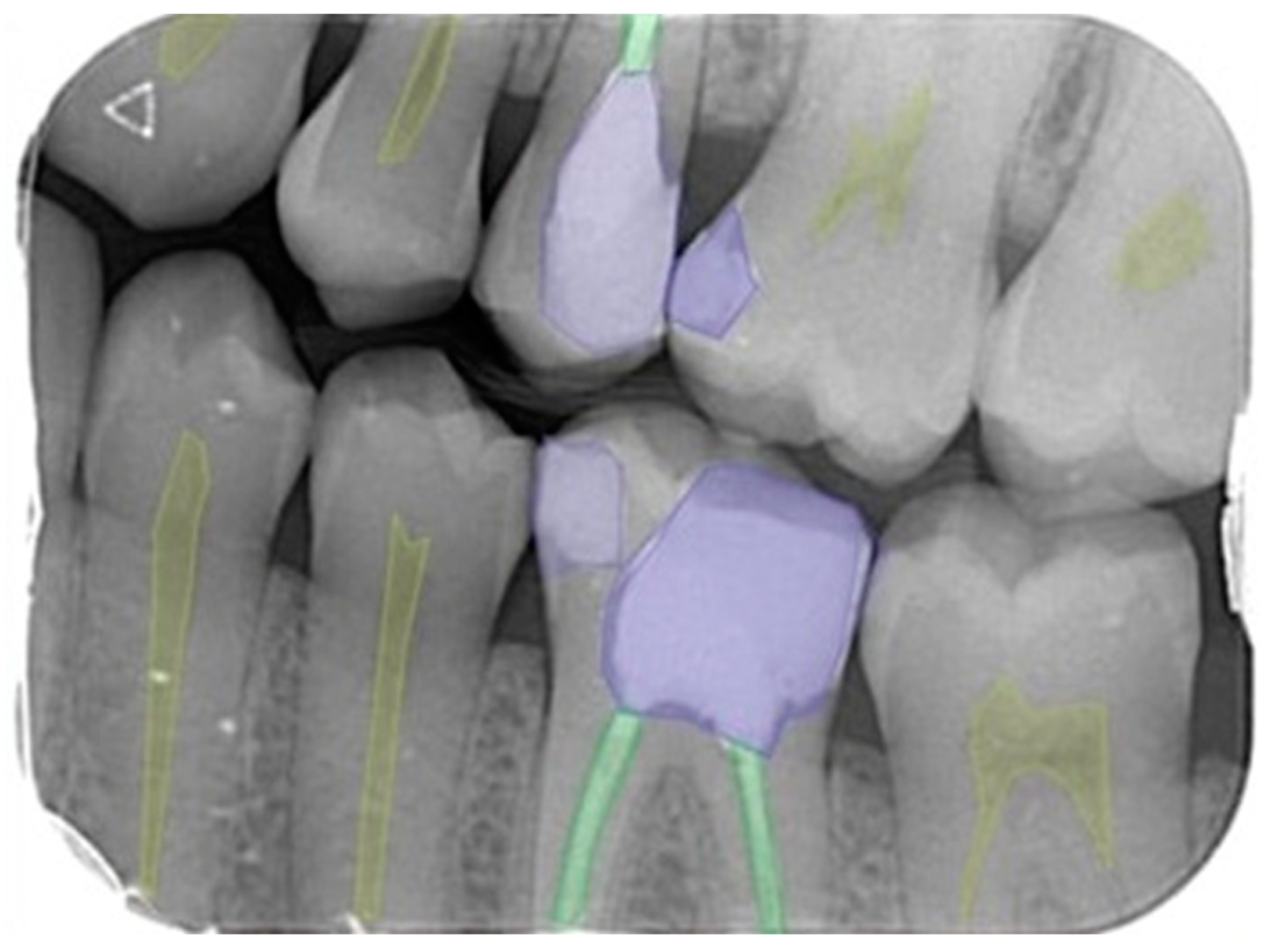 The ADEPT study: a comparative study of dentists' ability to