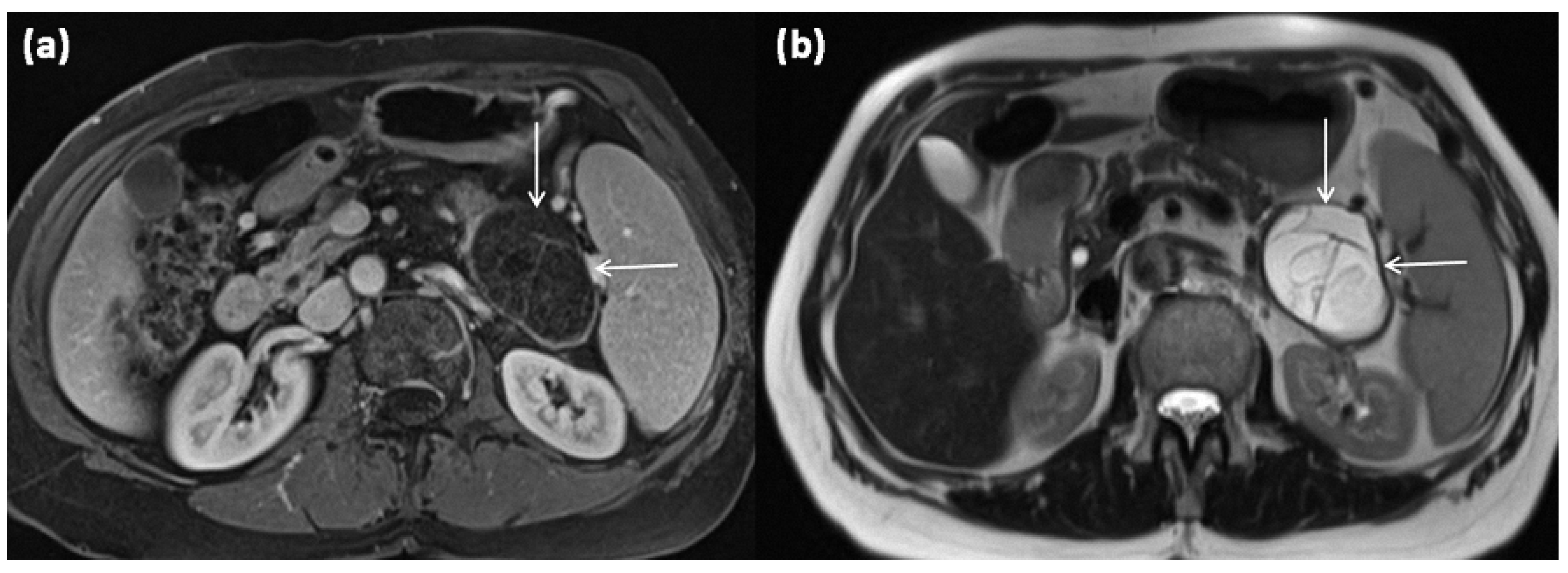 Diagnostics 13 00454 g005