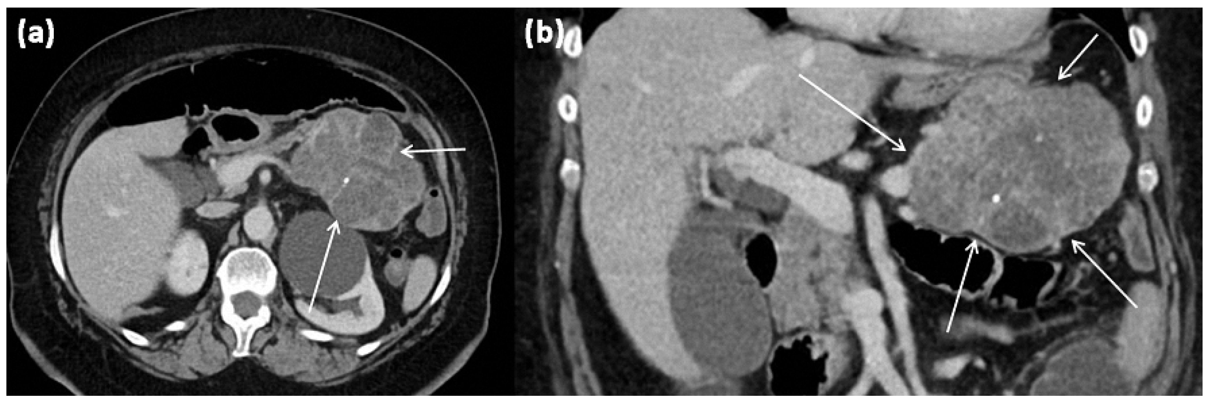 Diagnostics 13 00454 g007