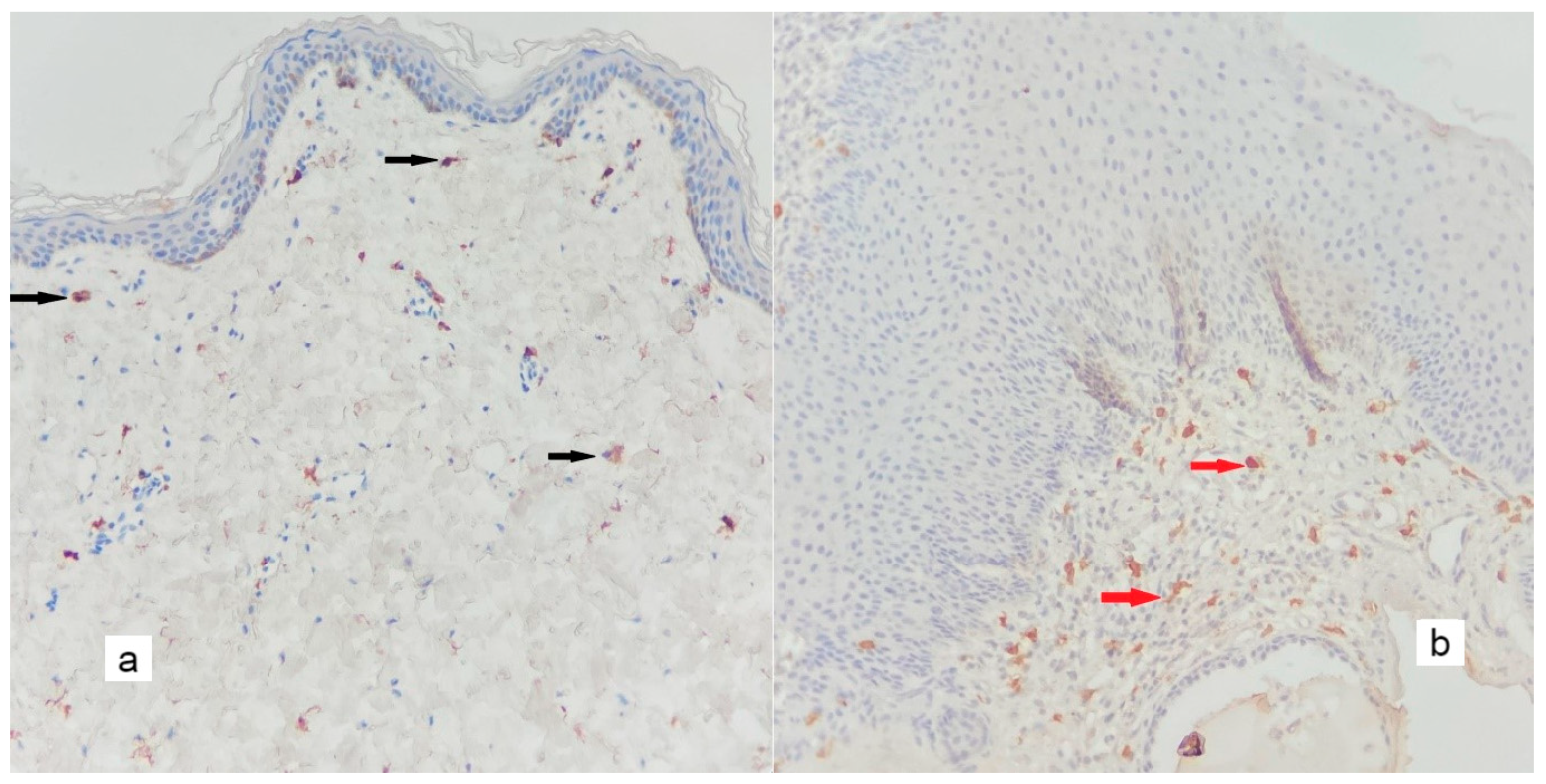 Diagnostics 13 00455 g004 Diagnostics 13 00455 g004