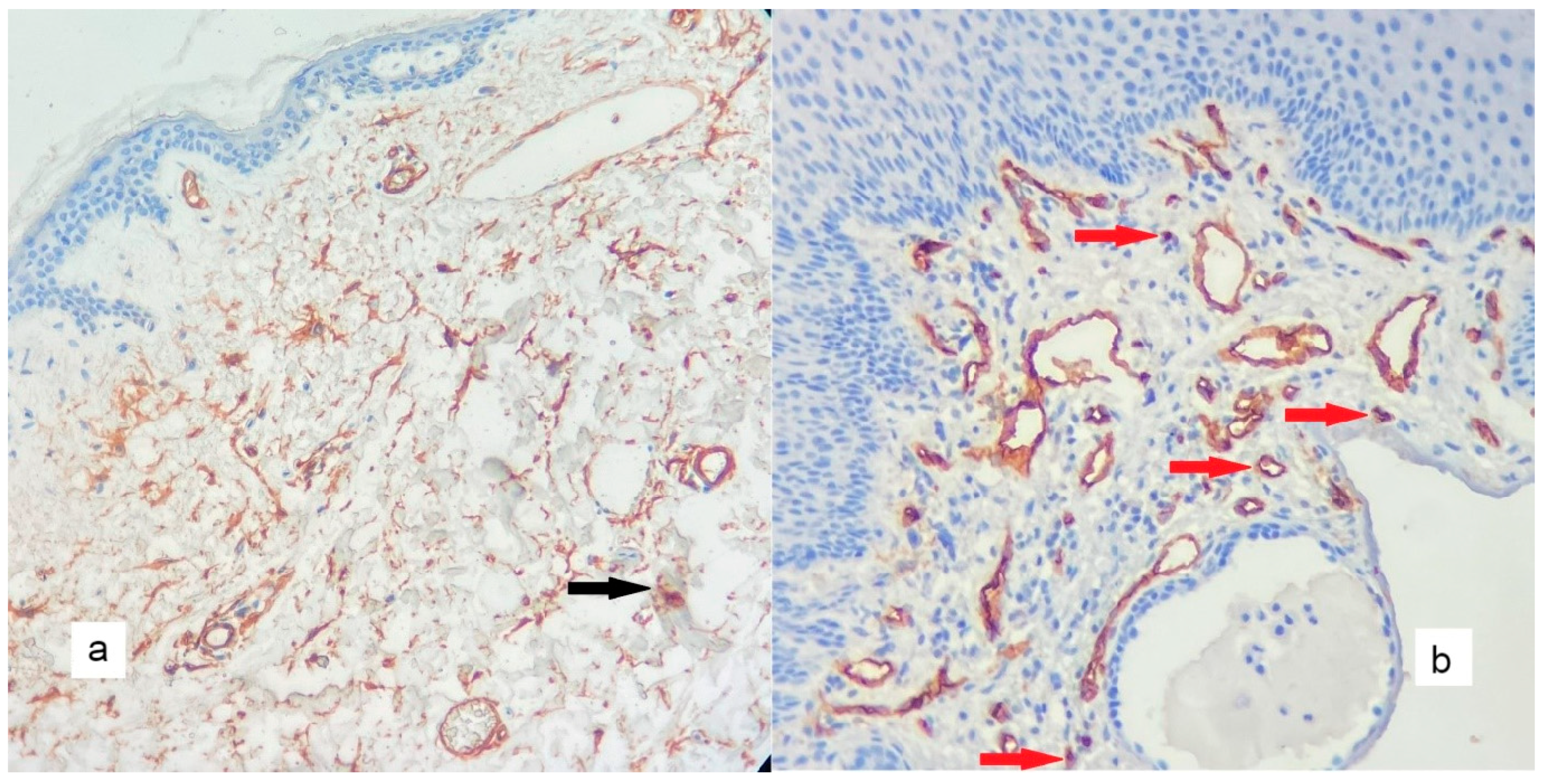 Diagnostics 13 00455 g005 Diagnostics 13 00455 g005