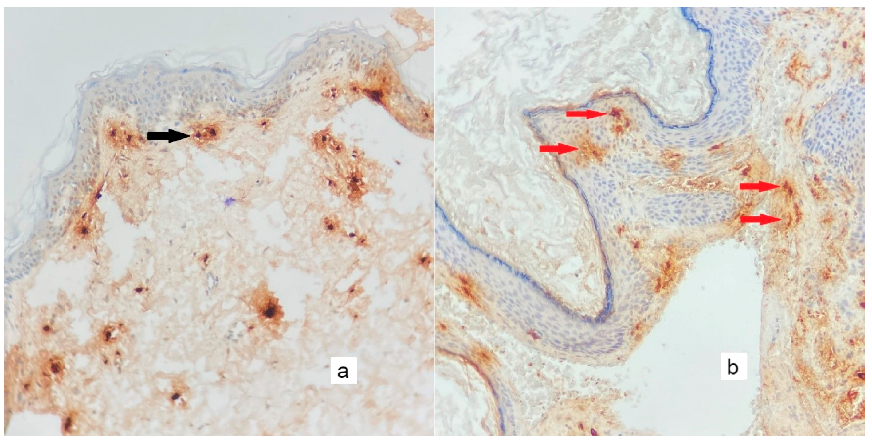 Diagnostics 13 00455 g007 Diagnostics 13 00455 g007