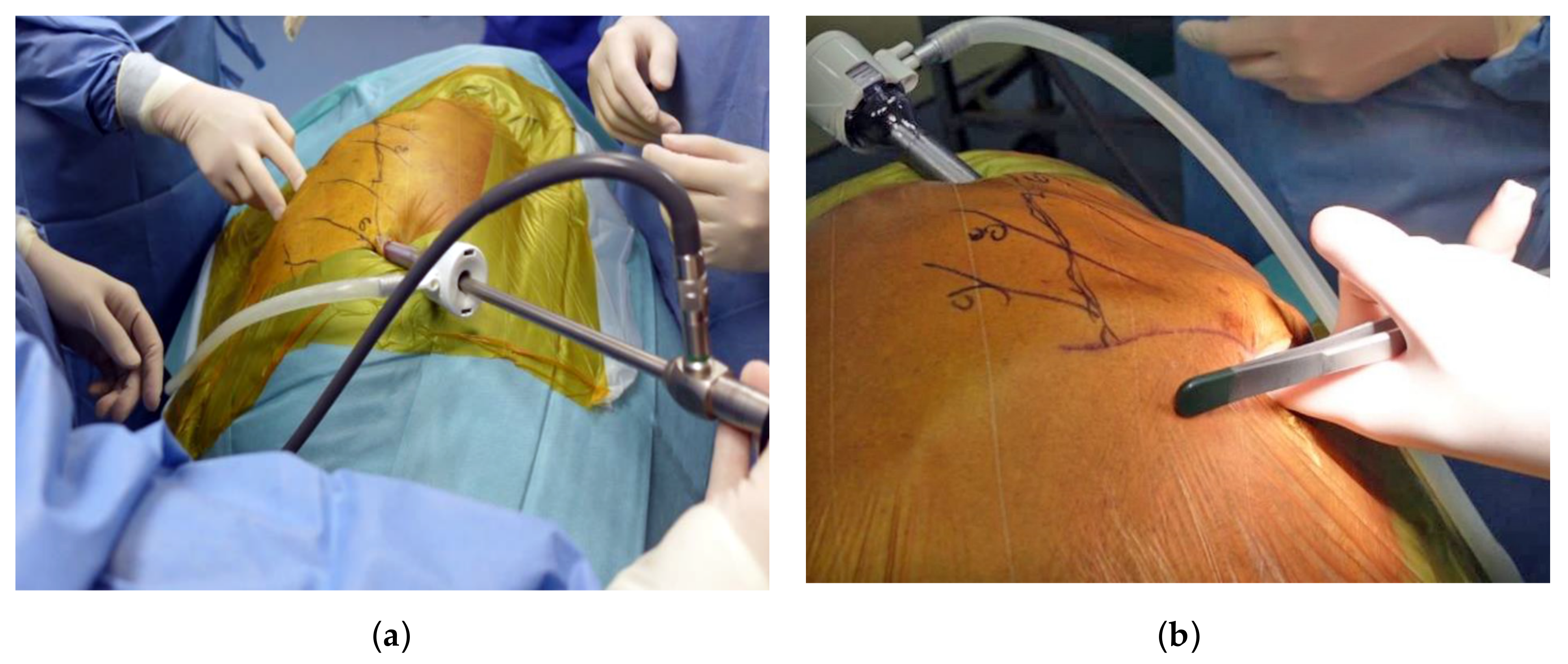 Diagnostics 13 00460 g002 Diagnostics 13 00460 g002