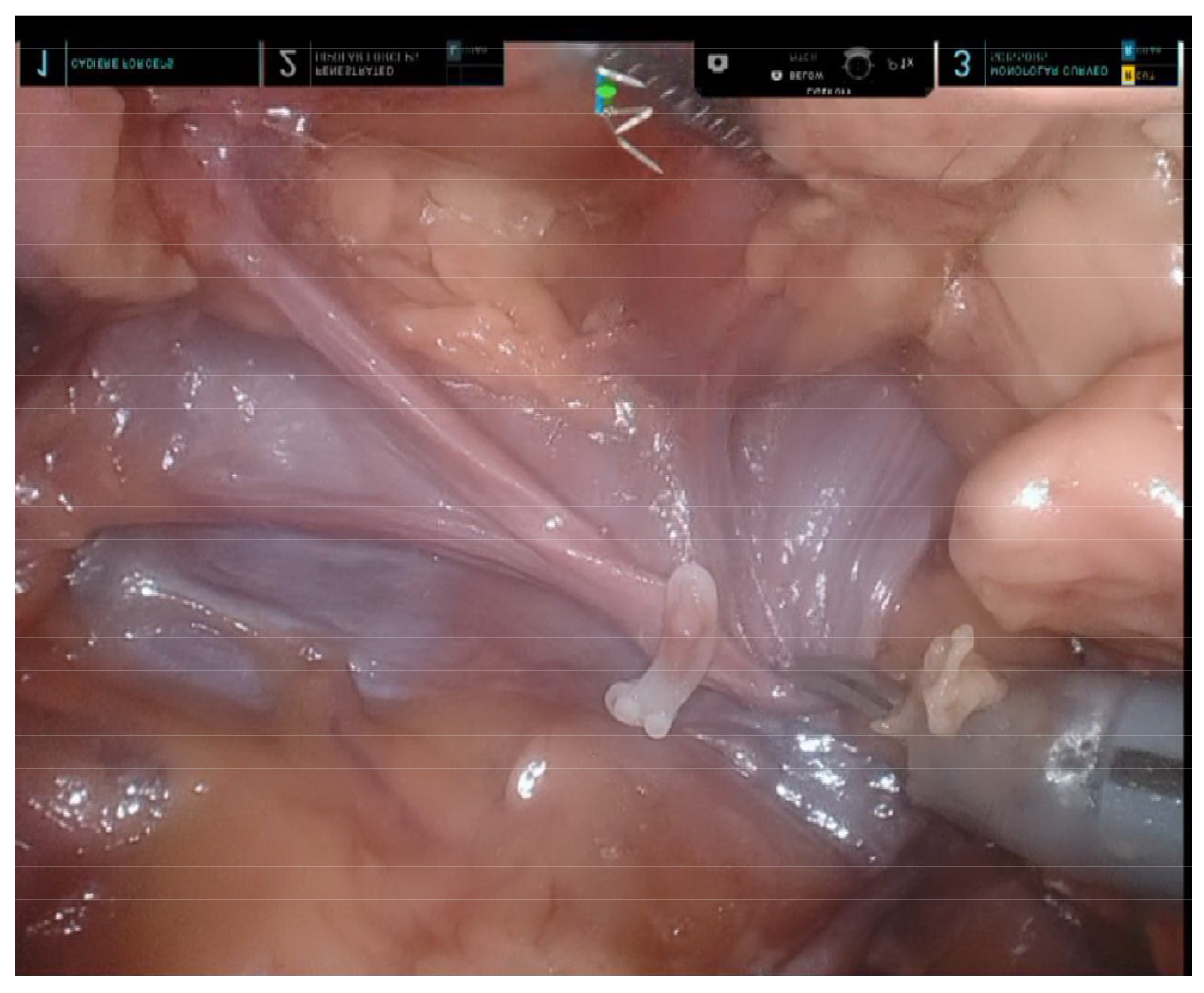 Diagnostics 13 00460 g003 Diagnostics 13 00460 g003