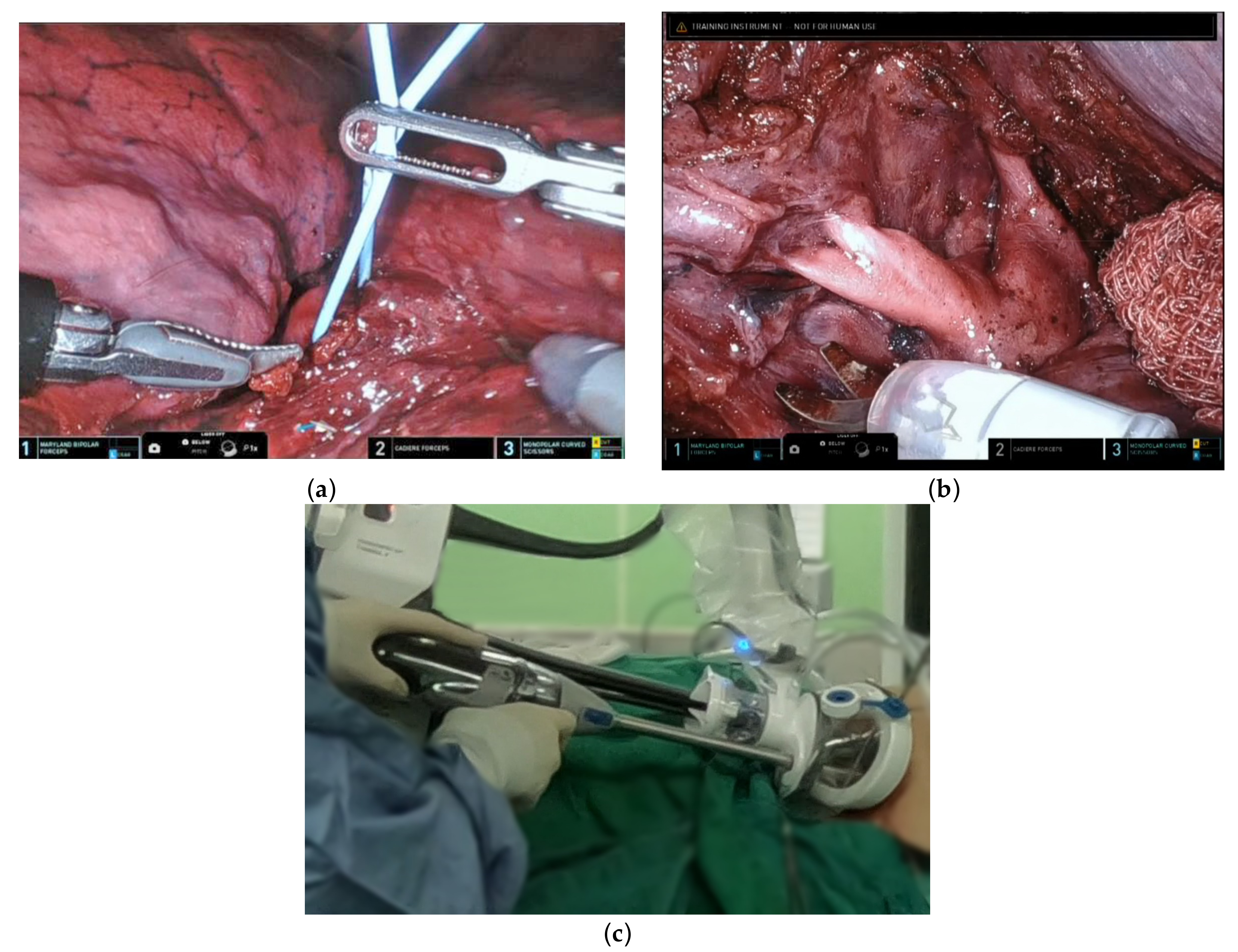 Diagnostics 13 00460 g004 Diagnostics 13 00460 g004