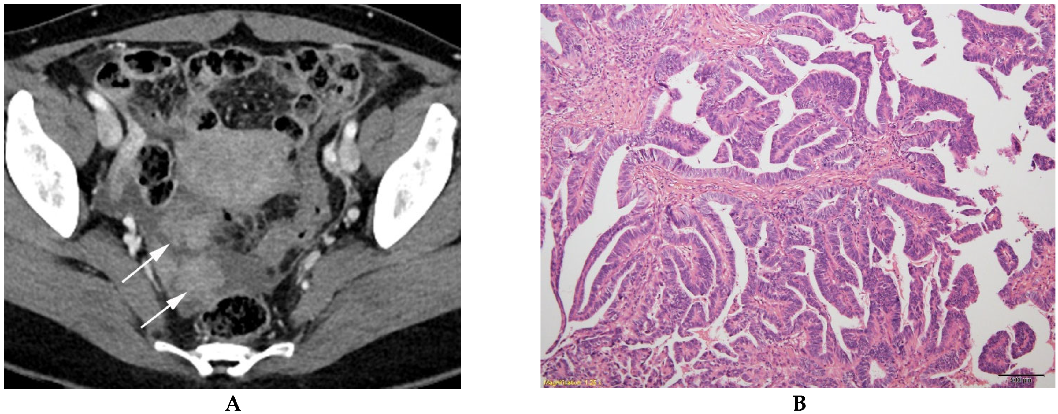Diagnostics 13 00480 g003