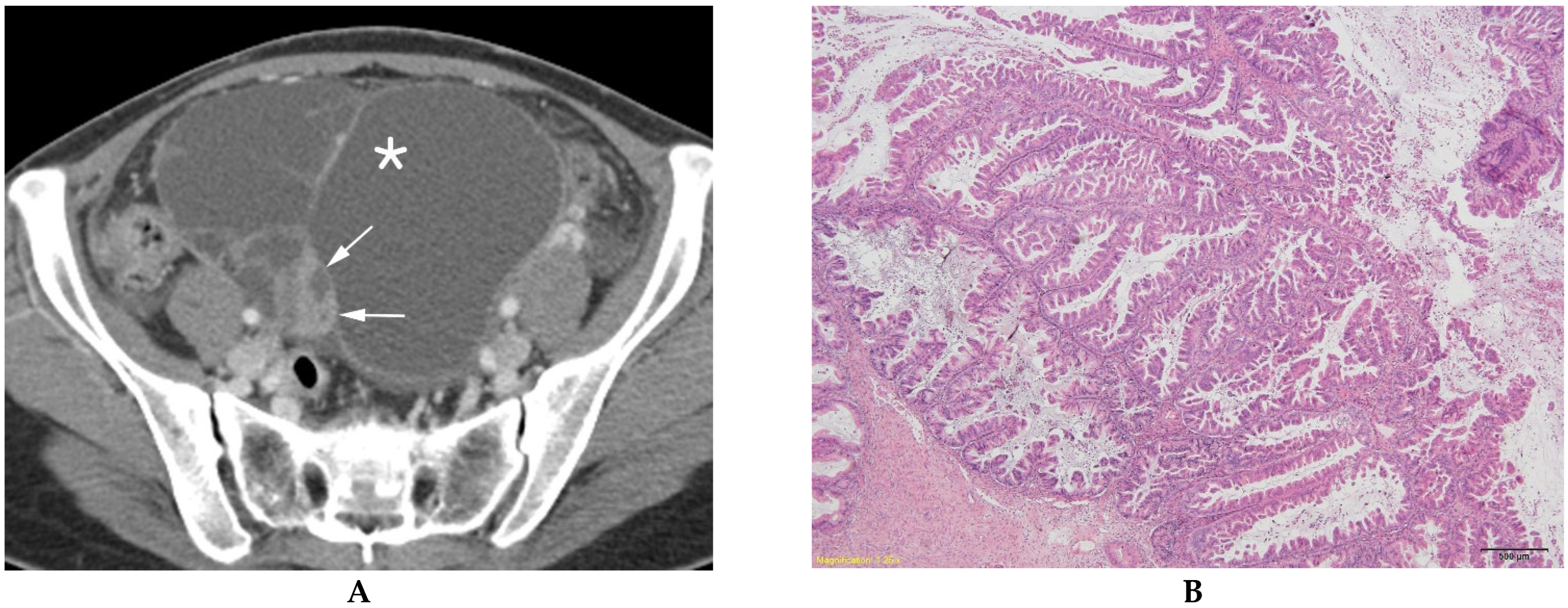 Diagnostics 13 00480 g004