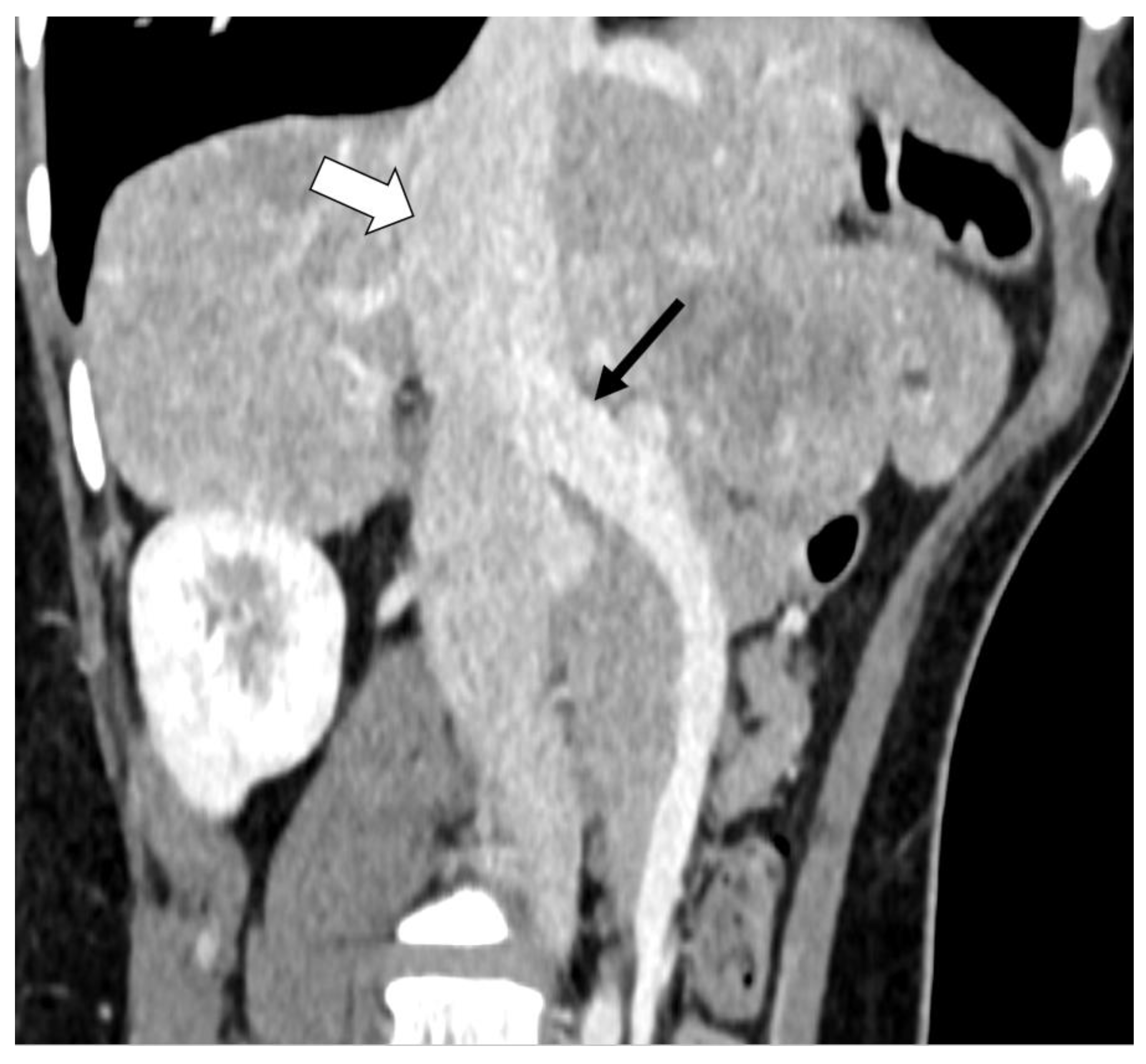 Diagnostics 13 00482 g002 Diagnostics 13 00482 g002