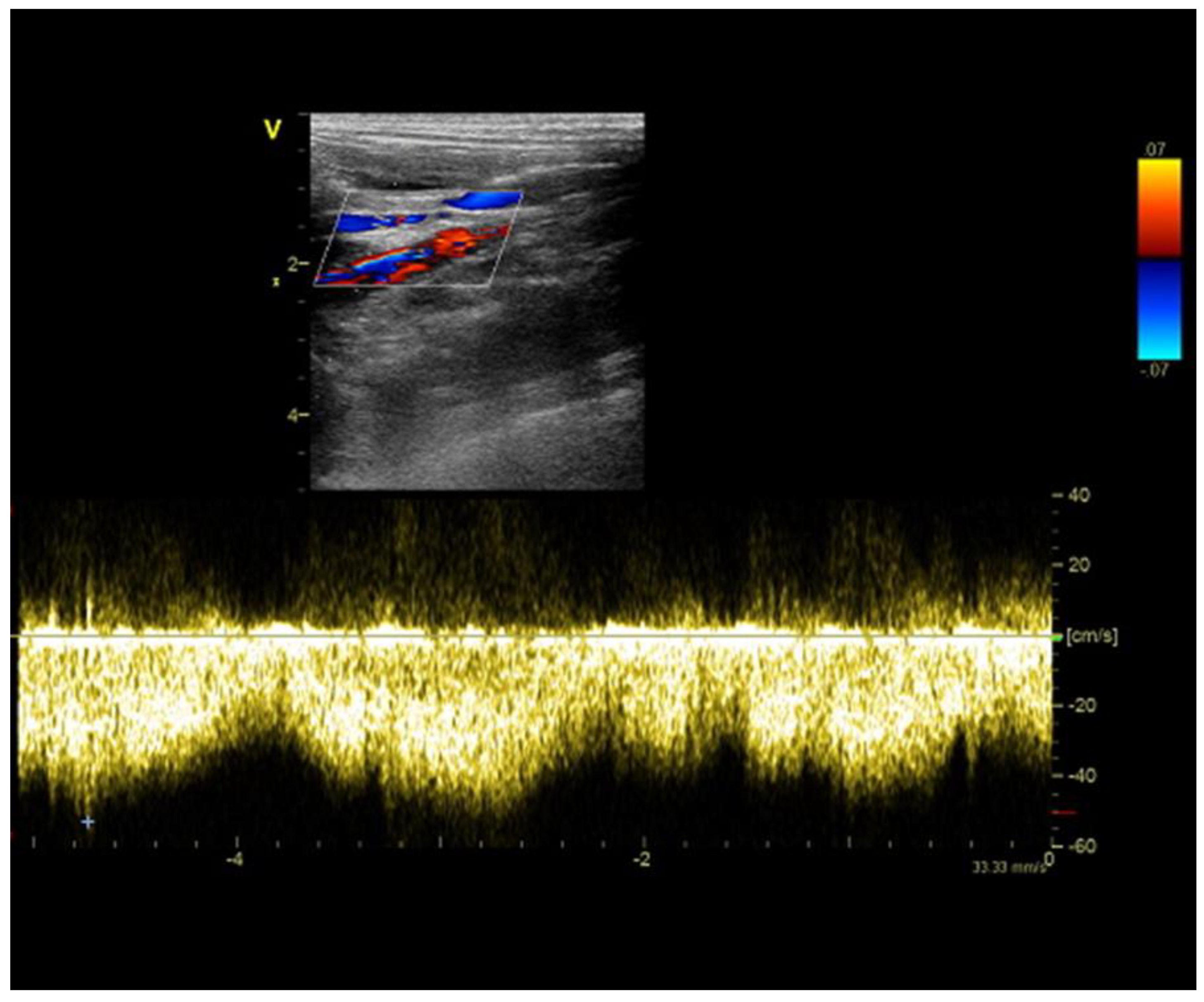 Diagnostics 13 00482 g003 Diagnostics 13 00482 g003