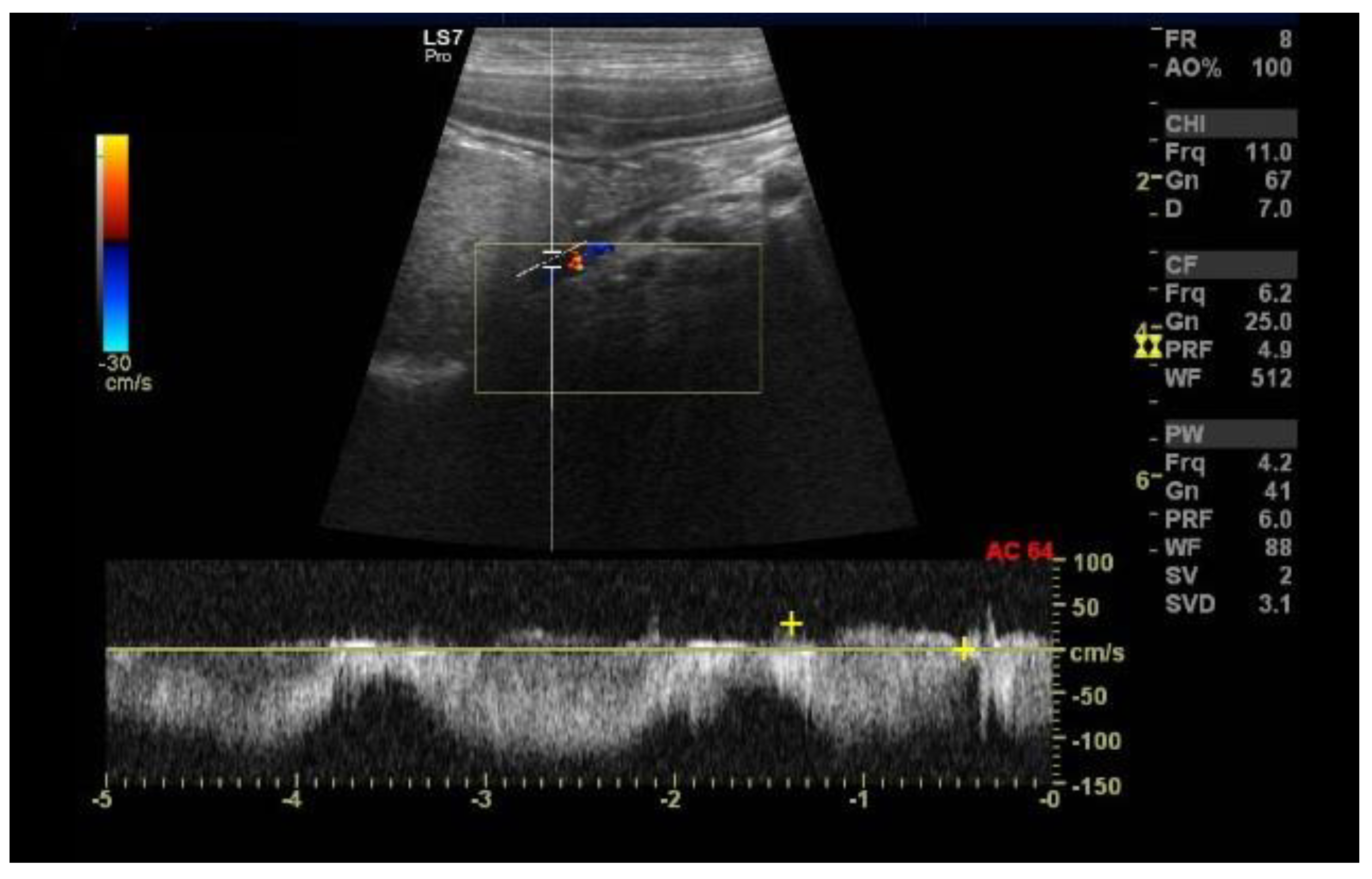 Diagnostics 13 00482 g005 Diagnostics 13 00482 g005