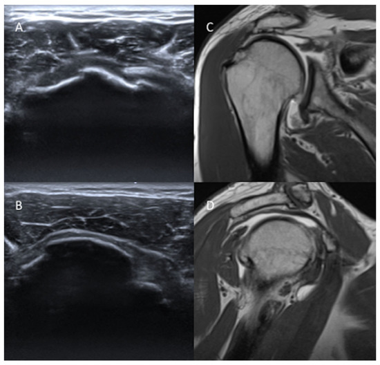 Diagnostics Free FullText Can We Apply Snyder’s Arthroscopic