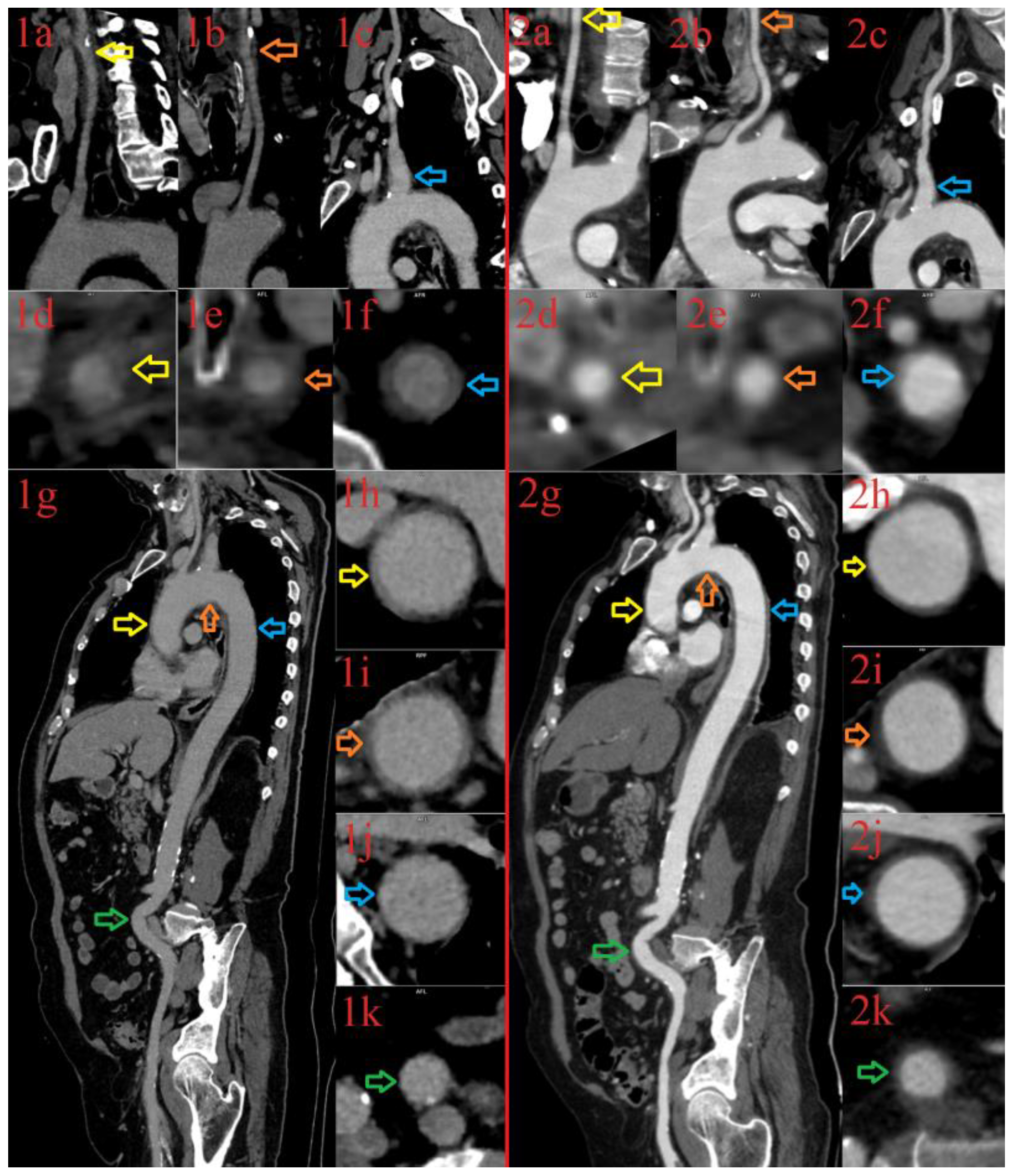 Diagnostics 13 00484 g001
