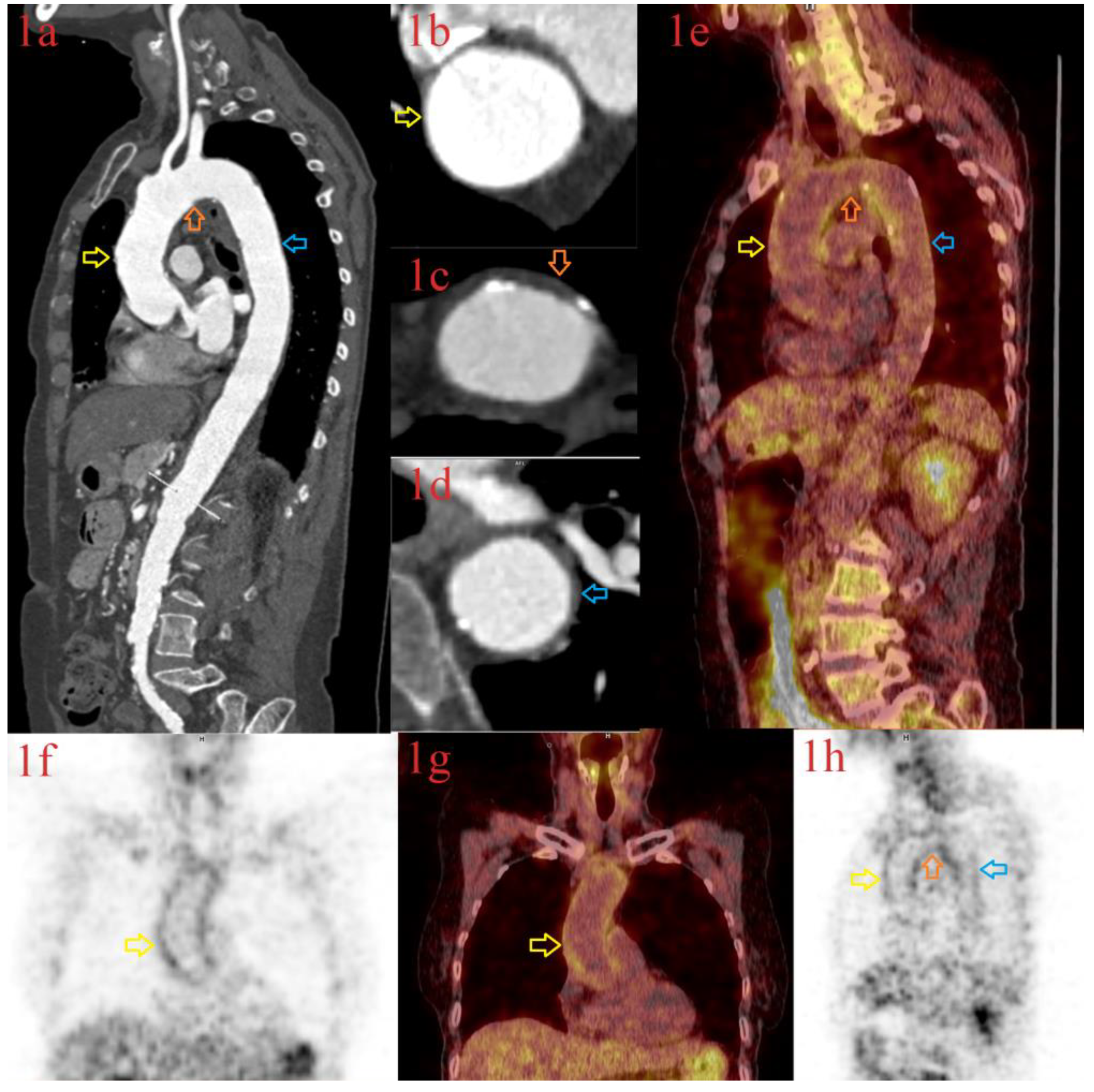 Diagnostics 13 00484 g003