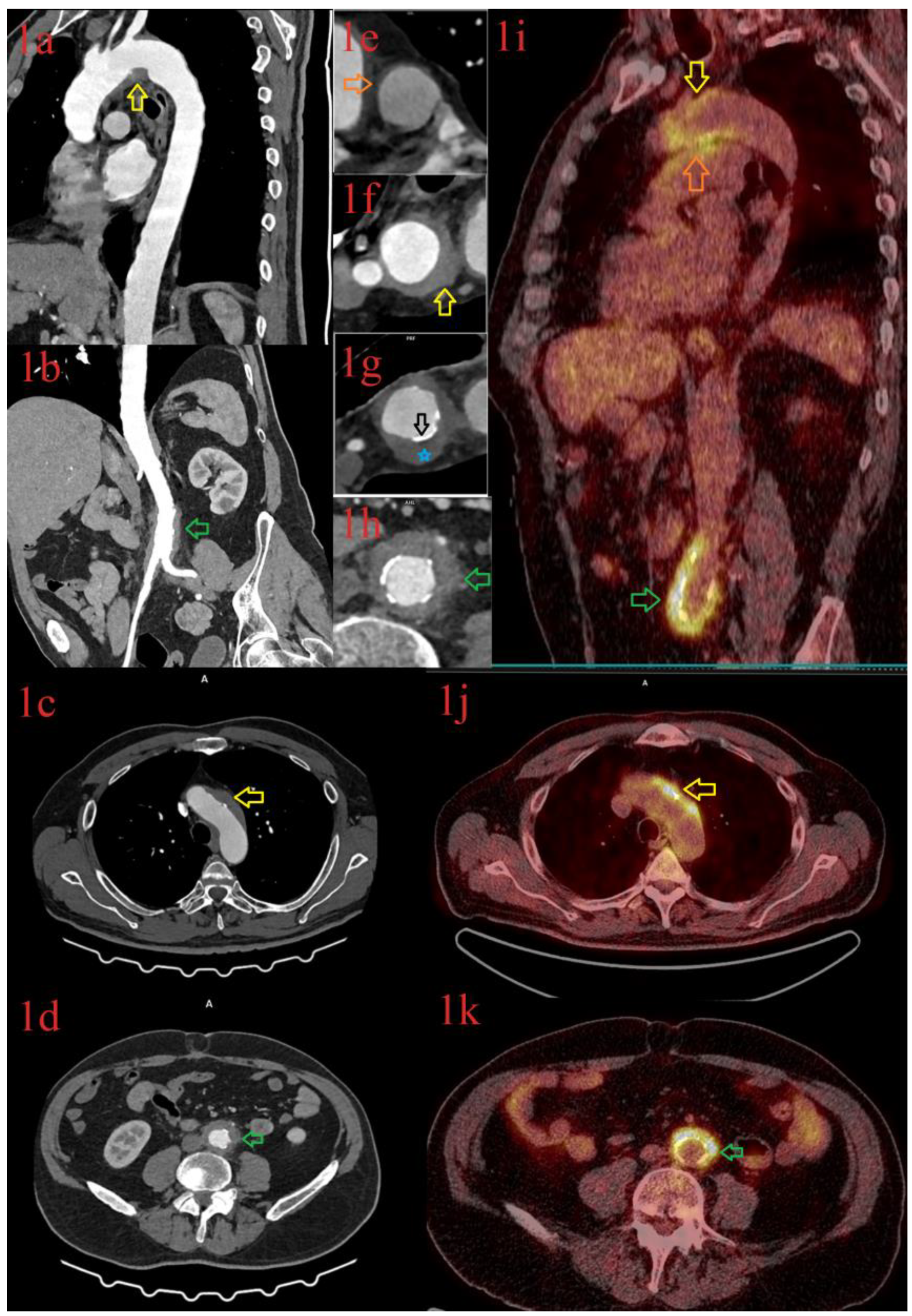 Diagnostics 13 00484 g004