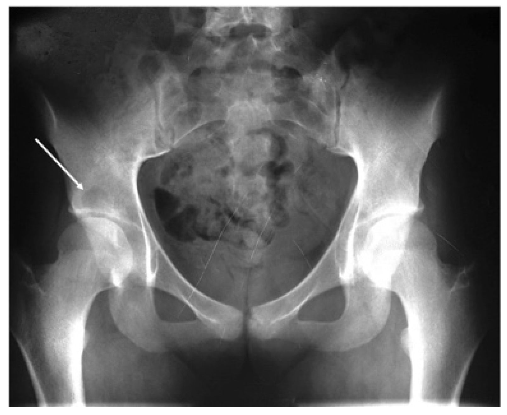 Diagnostics 13 00485 g001 Diagnostics 13 00485 g001