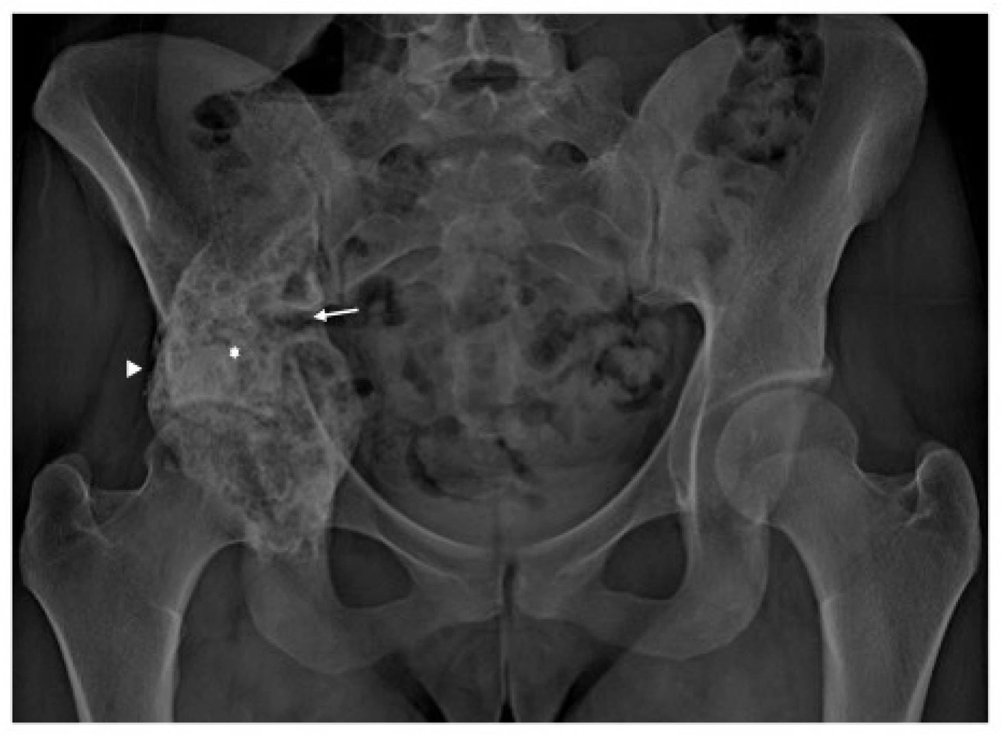 Diagnostics 13 00485 g002 Diagnostics 13 00485 g002