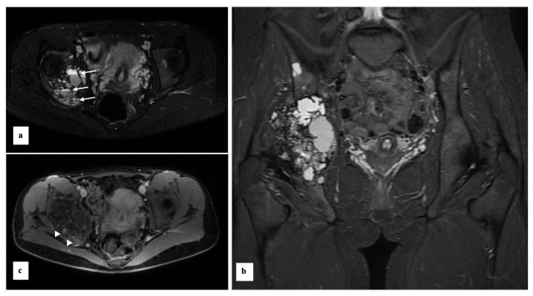 Diagnostics 13 00485 g004 Diagnostics 13 00485 g004