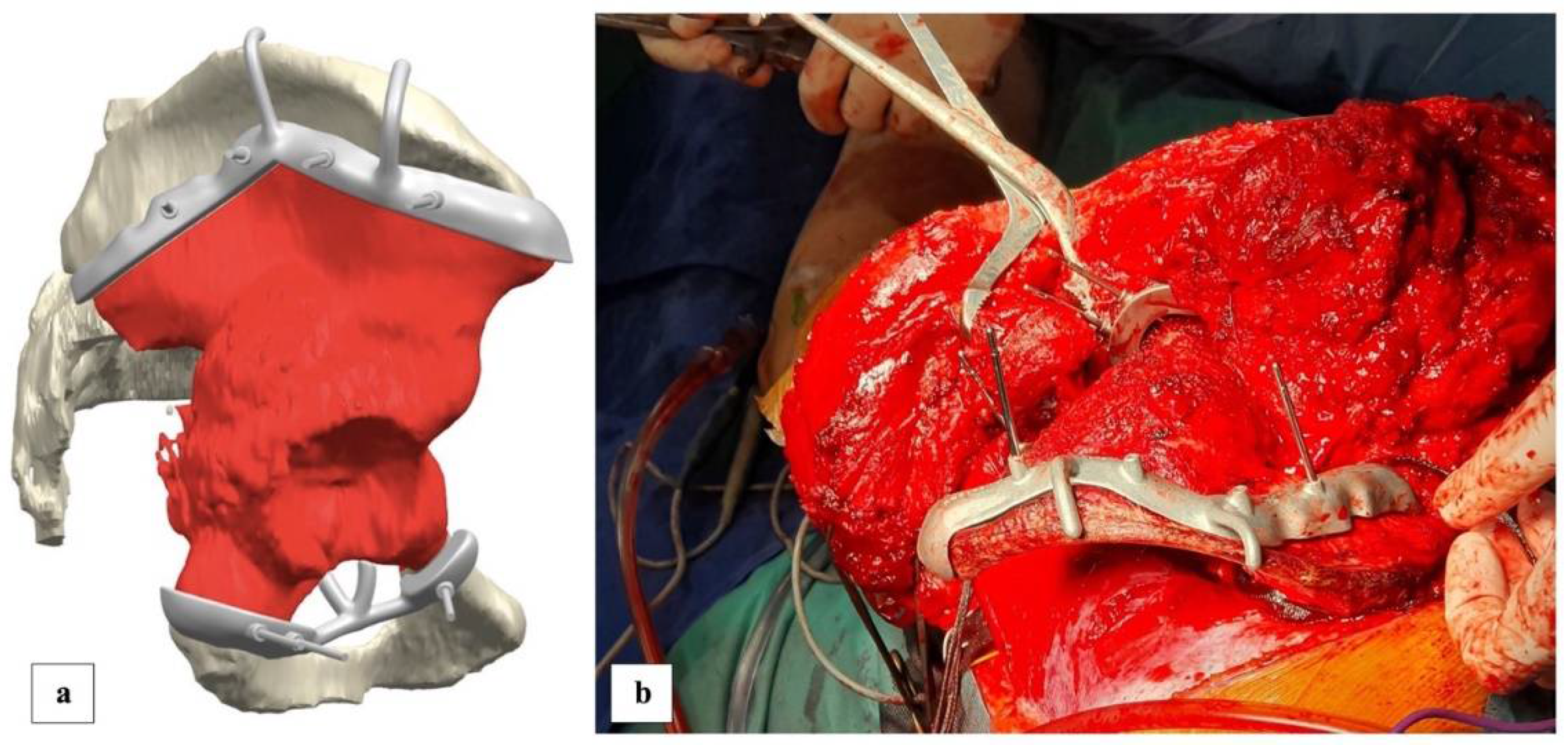Diagnostics 13 00485 g005 Diagnostics 13 00485 g005