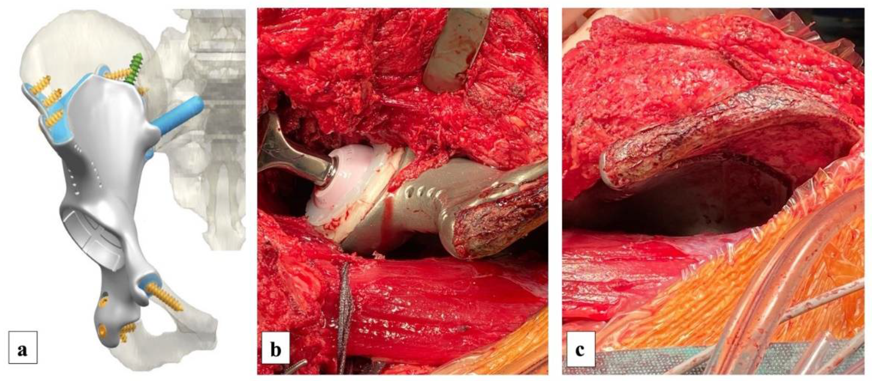 Diagnostics 13 00485 g006 Diagnostics 13 00485 g006