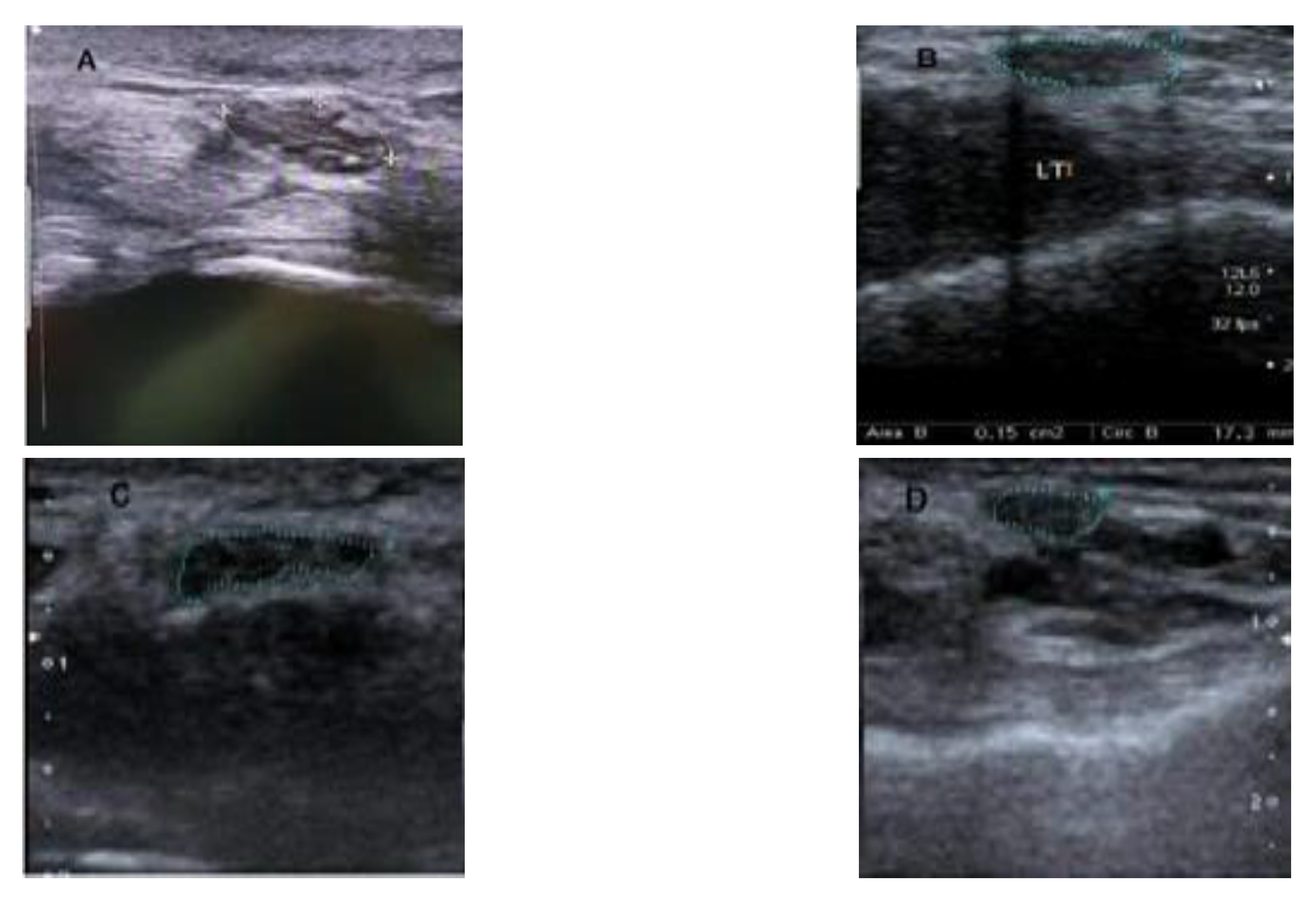 Diagnostics 13 00492 g001 Diagnostics 13 00492 g001