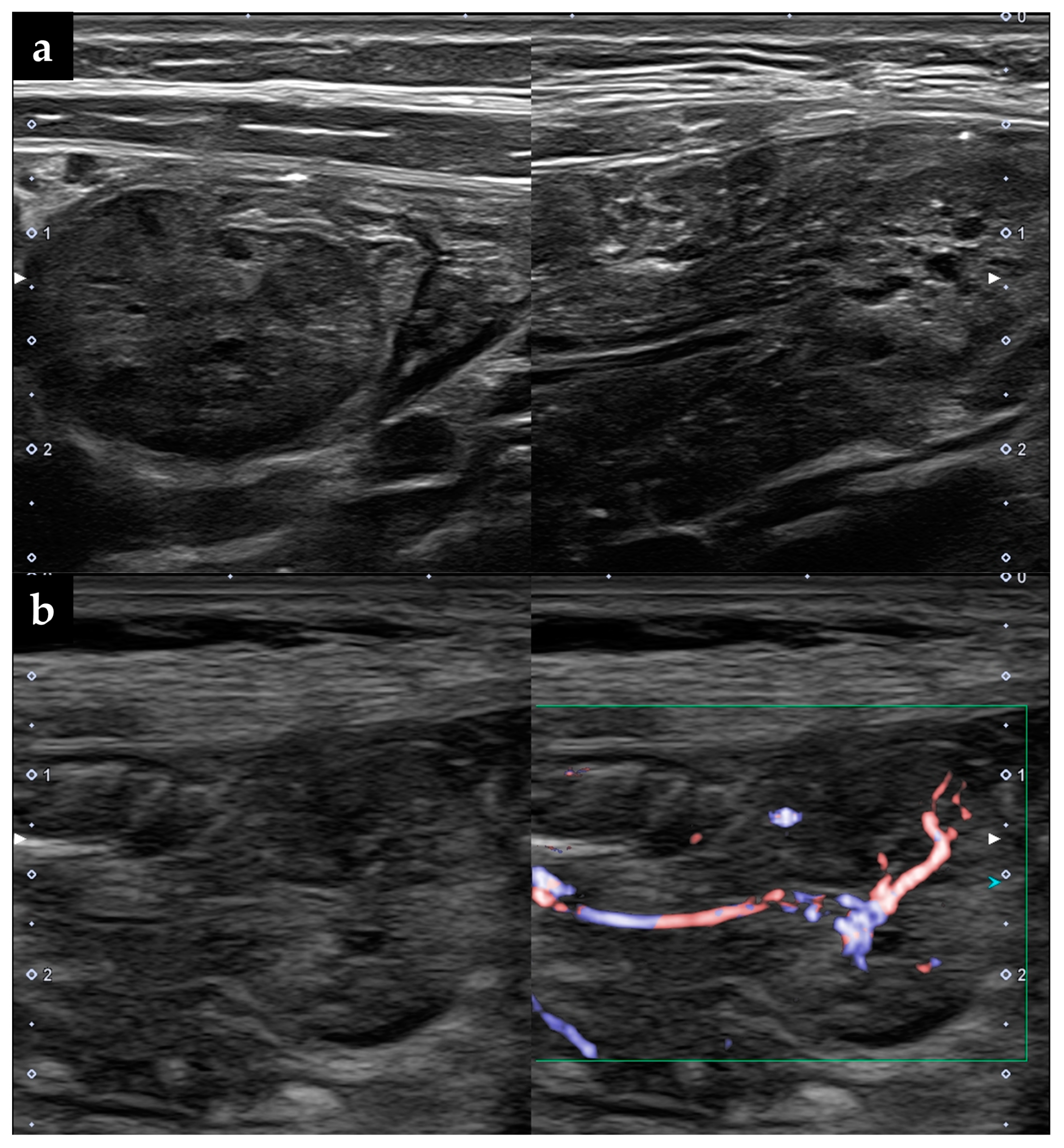 Diagnostics 13 00494 g001 Diagnostics 13 00494 g001