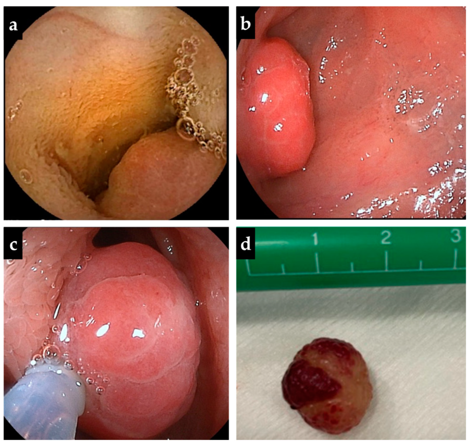 Diagnostics 13 00494 g002 Diagnostics 13 00494 g002