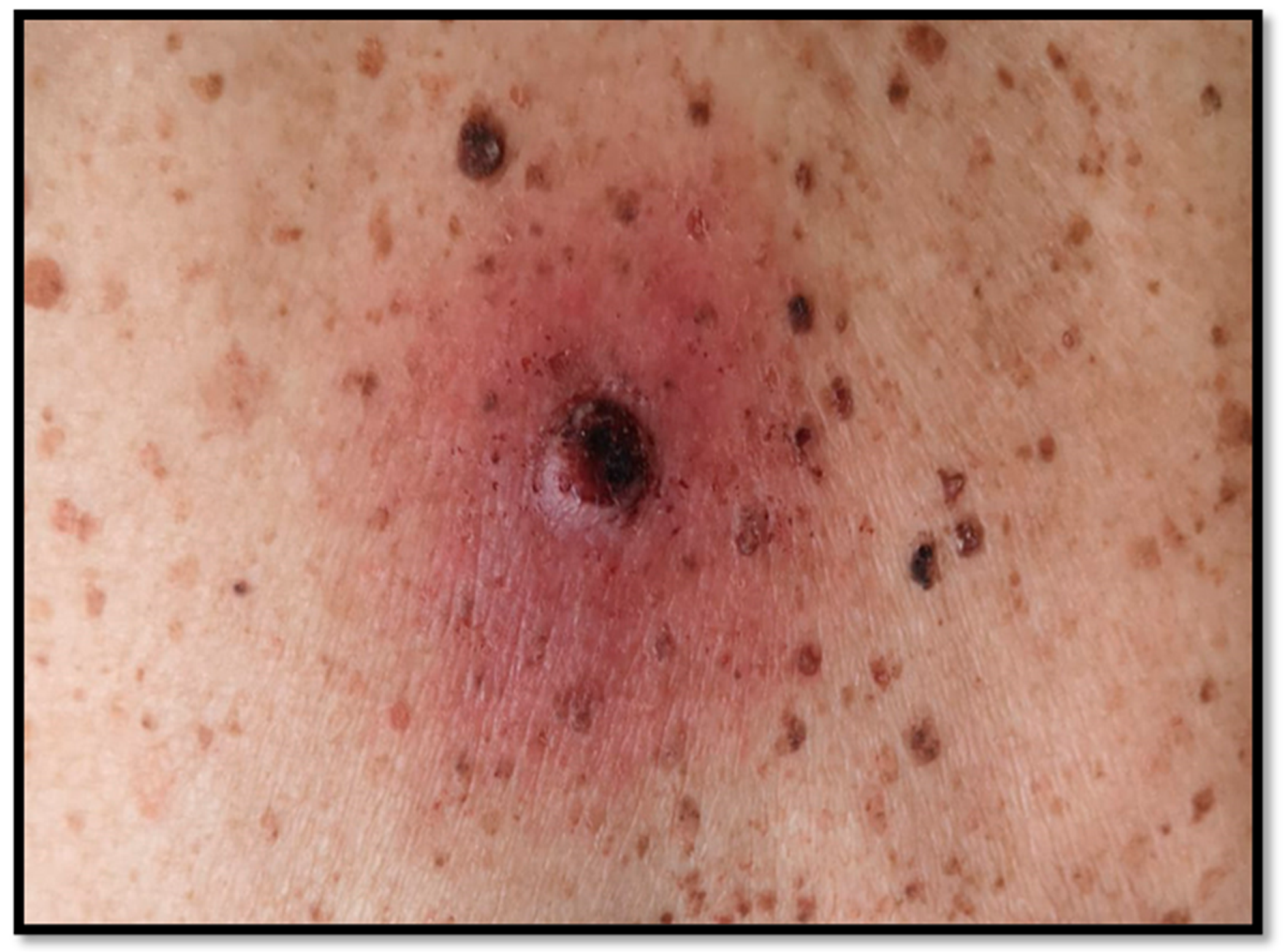 Diagnostics 13 00495 g001 Diagnostics 13 00495 g001