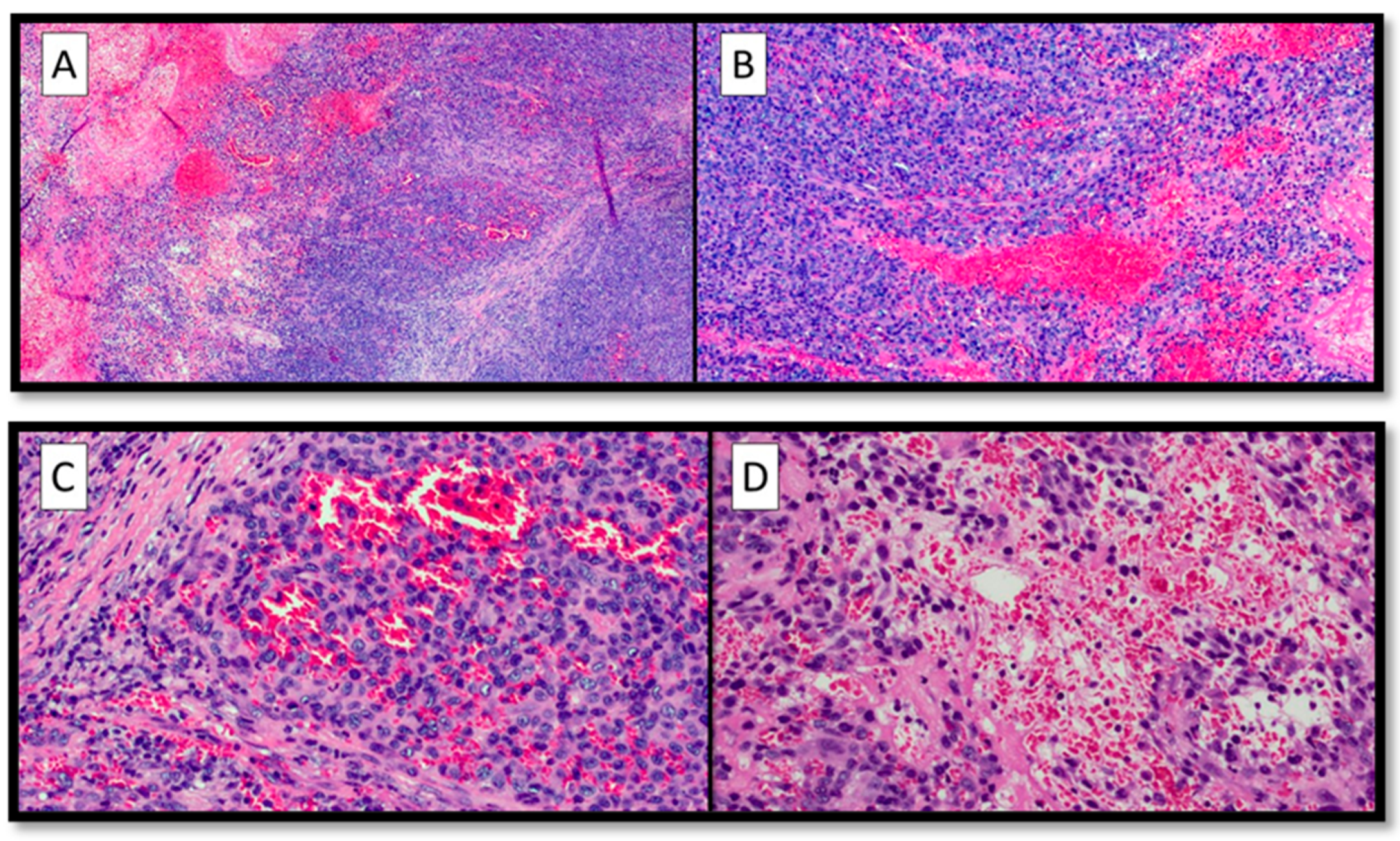 Diagnostics 13 00495 g002 Diagnostics 13 00495 g002