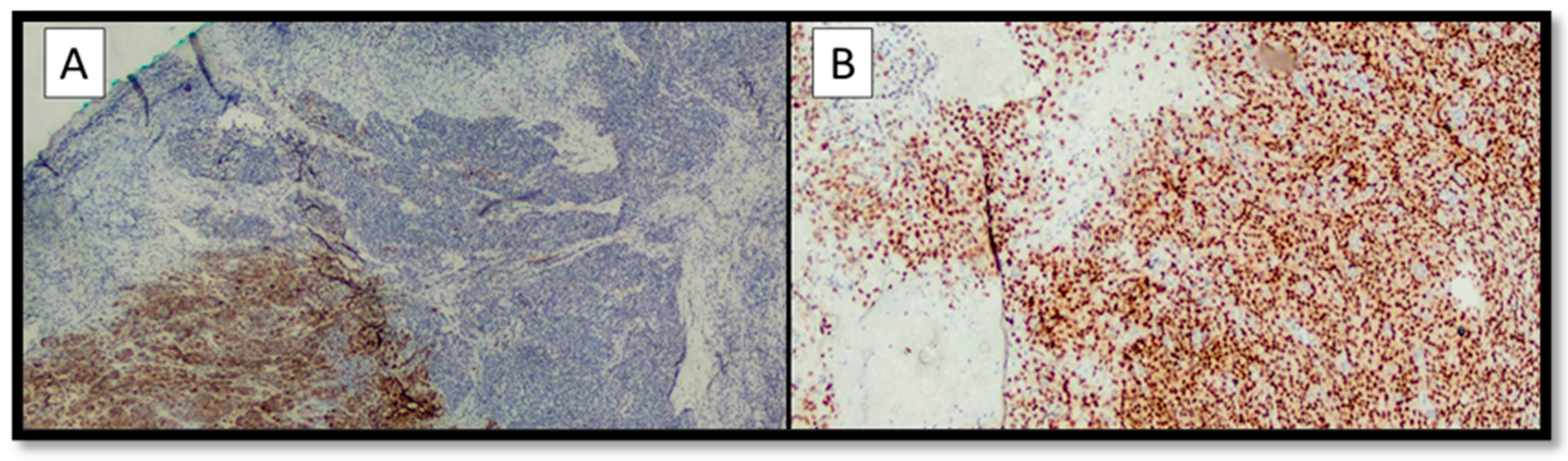 Diagnostics 13 00495 g003 Diagnostics 13 00495 g003