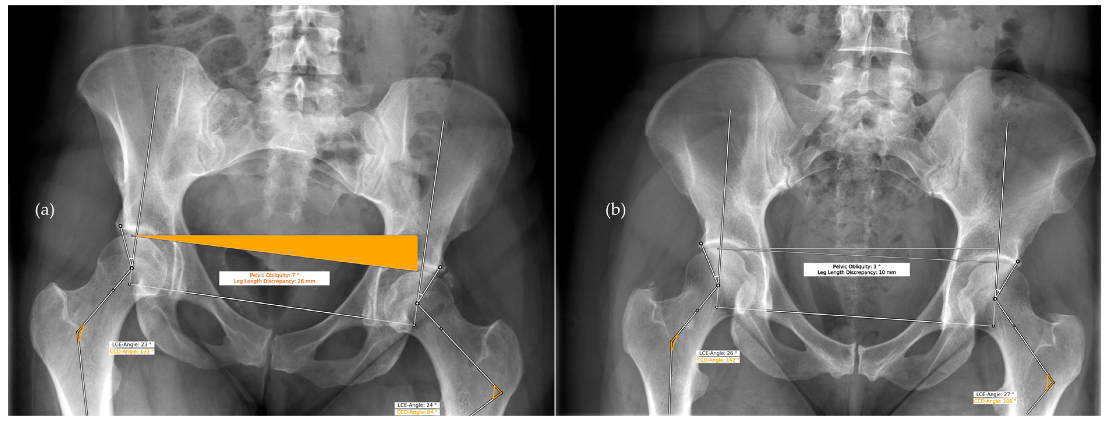 Diagnostics 13 00497 g004 Diagnostics 13 00497 g004