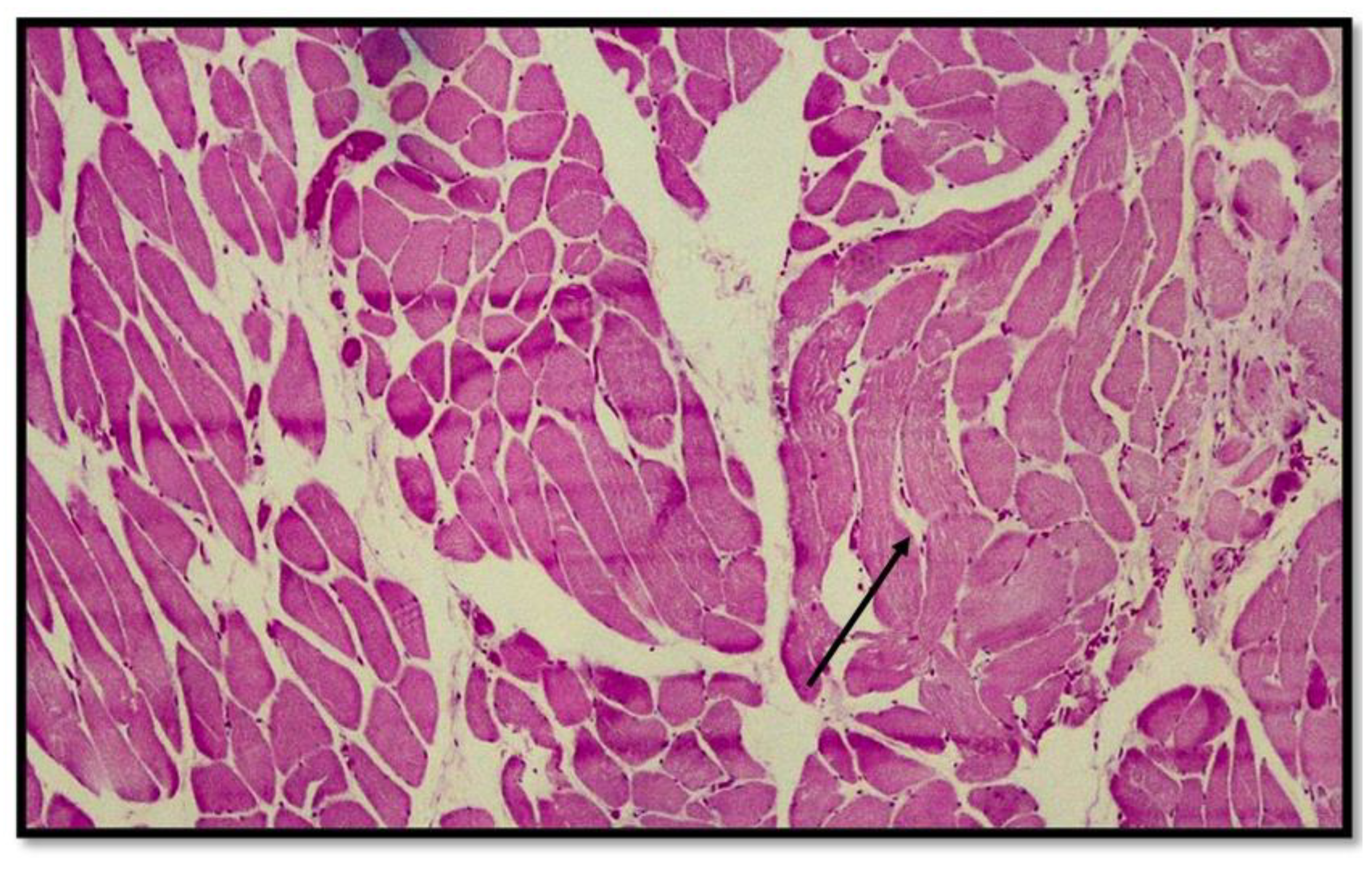 Diagnostics 13 00510 g005 Diagnostics 13 00510 g005