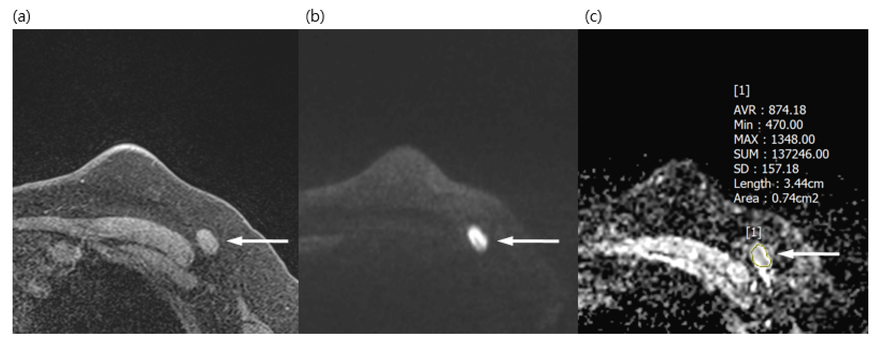 Diagnostics 13 00513 g001 Diagnostics 13 00513 g001