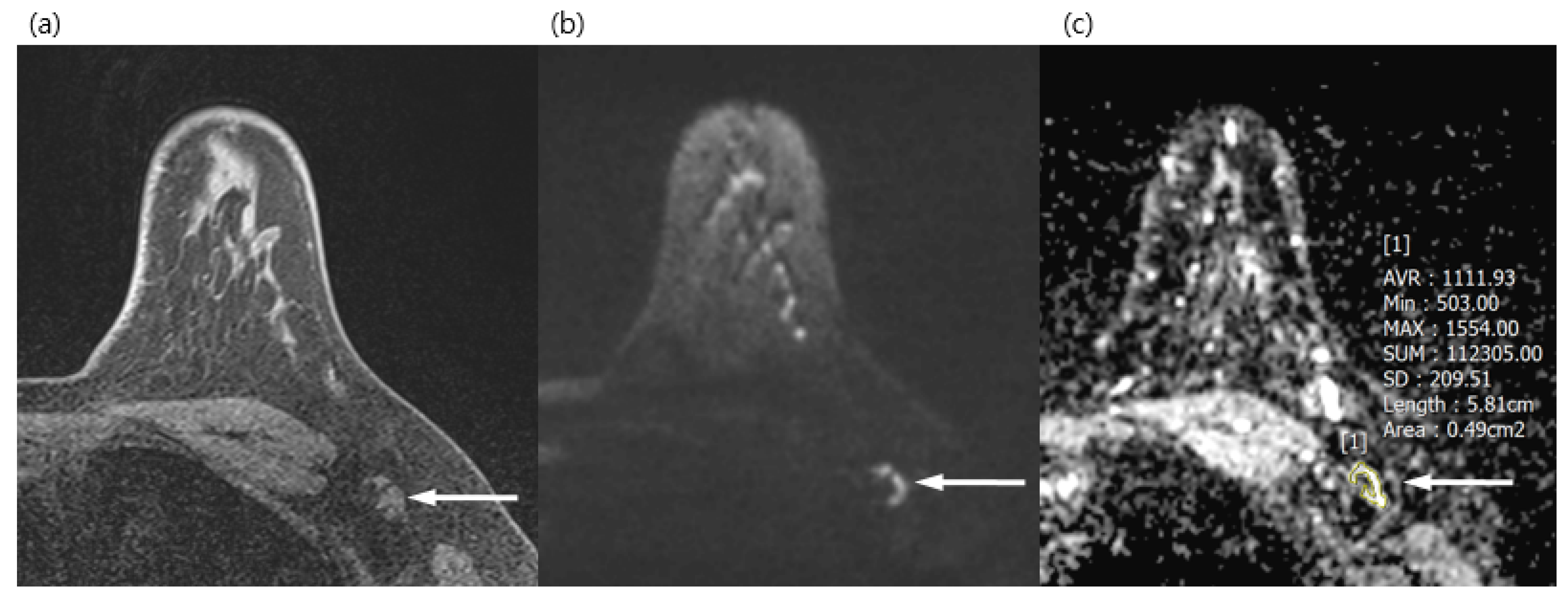 Diagnostics 13 00513 g002 Diagnostics 13 00513 g002