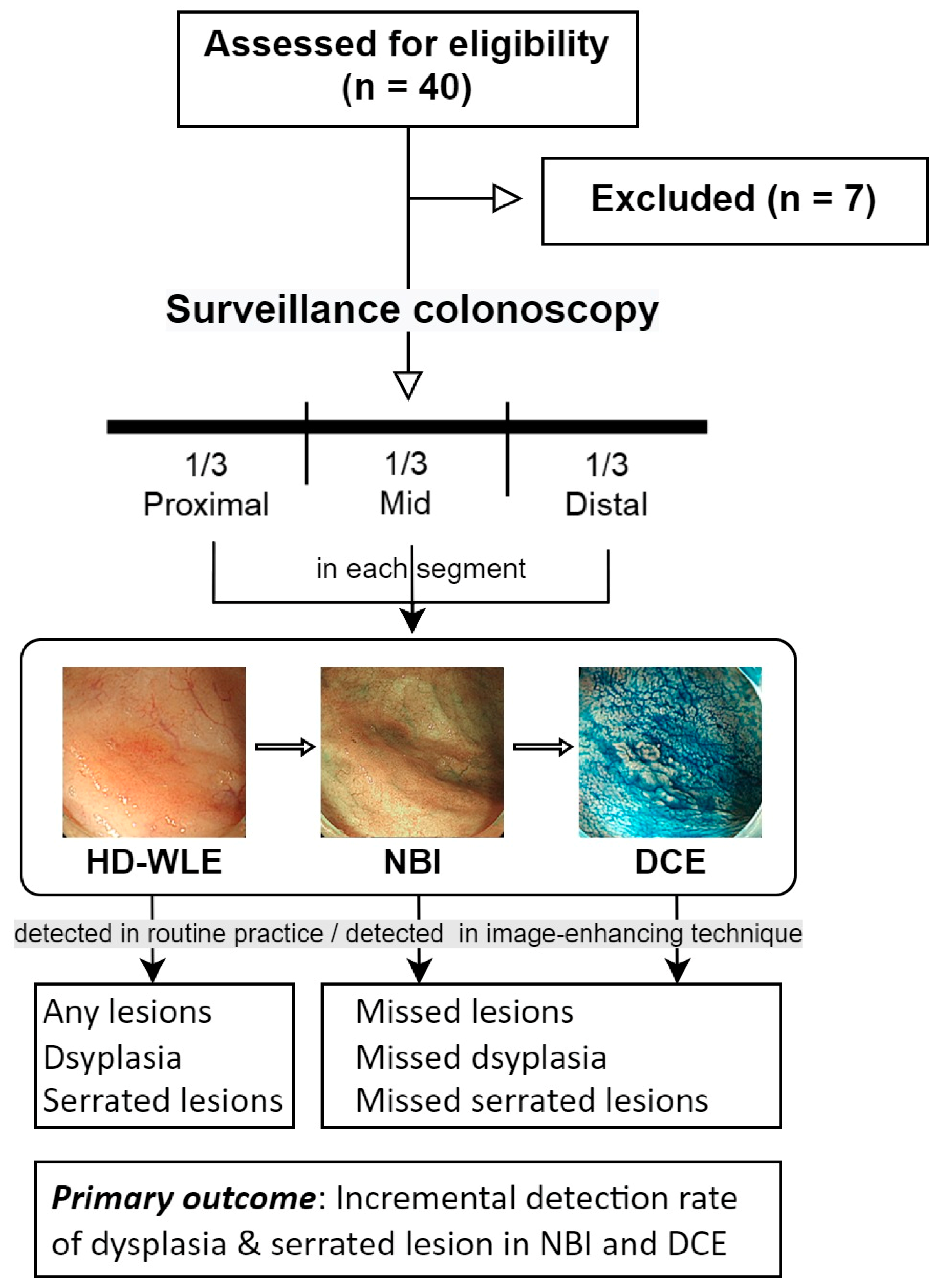 Diagnostics Free FullText Incremental Detection Rate of Dysplasia and Sessile Serrated