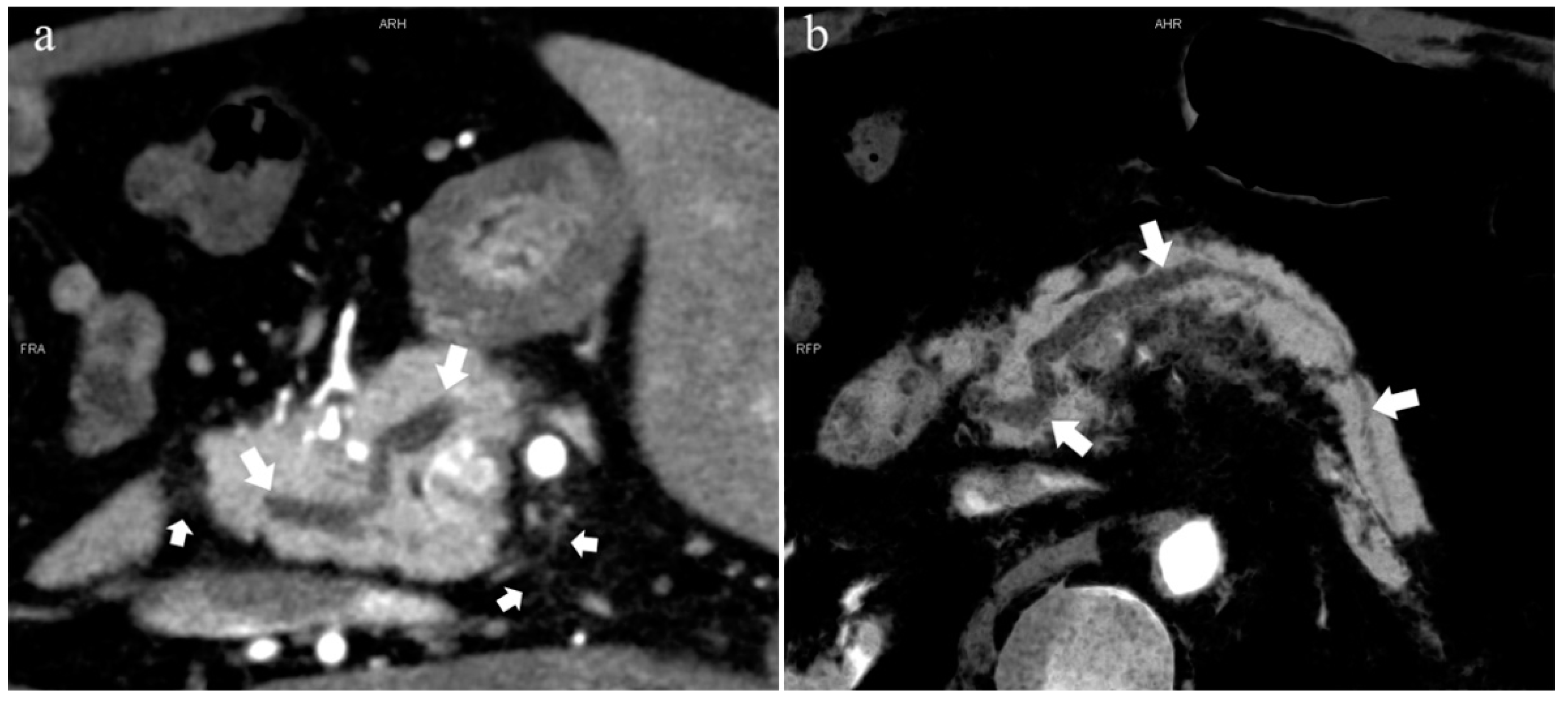 Diagnostics 13 00520 g004