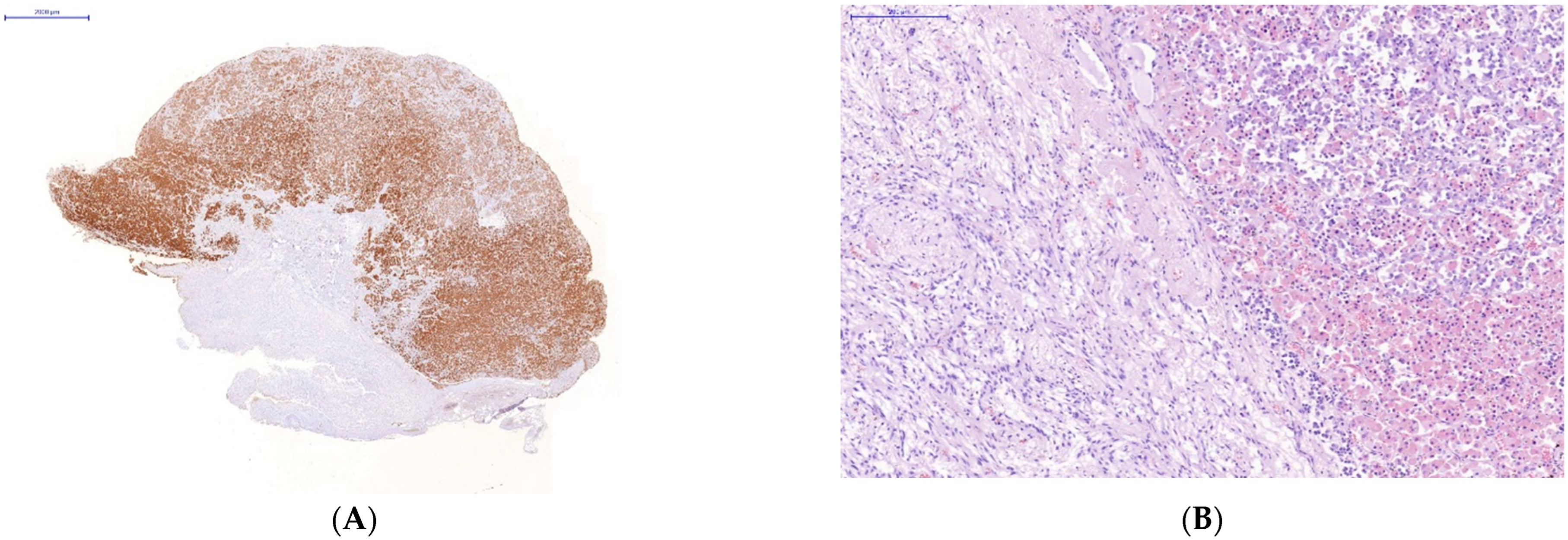 Diagnostics 13 00522 g002a Diagnostics 13 00522 g002a