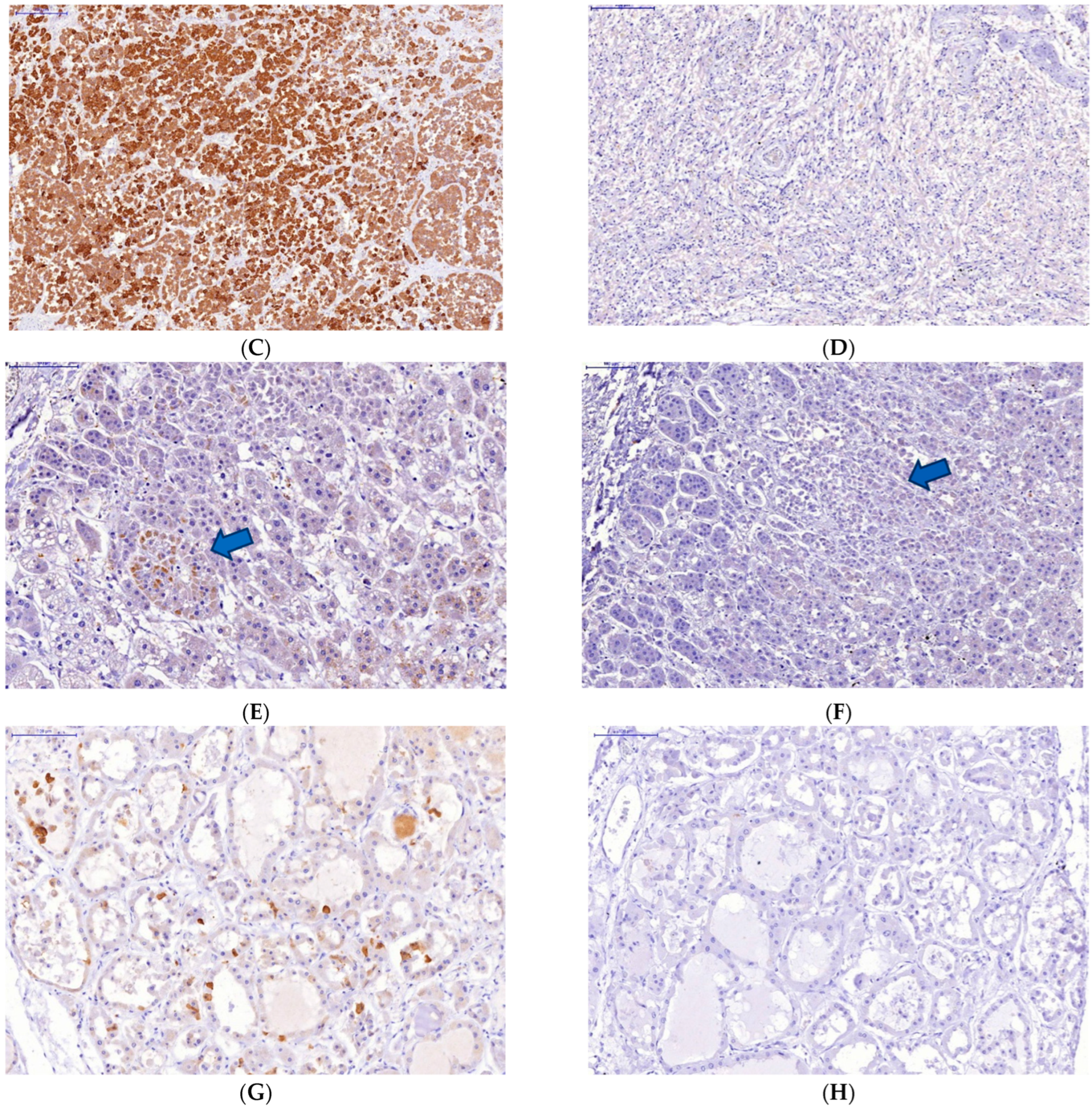 Diagnostics 13 00522 g002b Diagnostics 13 00522 g002b