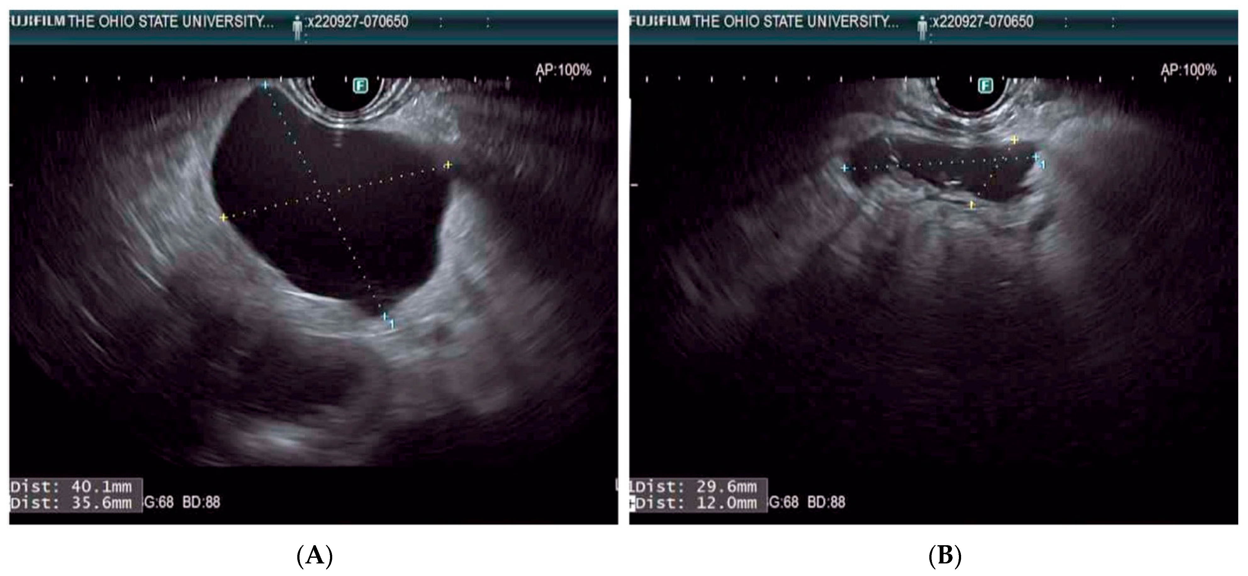 Diagnostics 13 00536 g002 Diagnostics 13 00536 g002