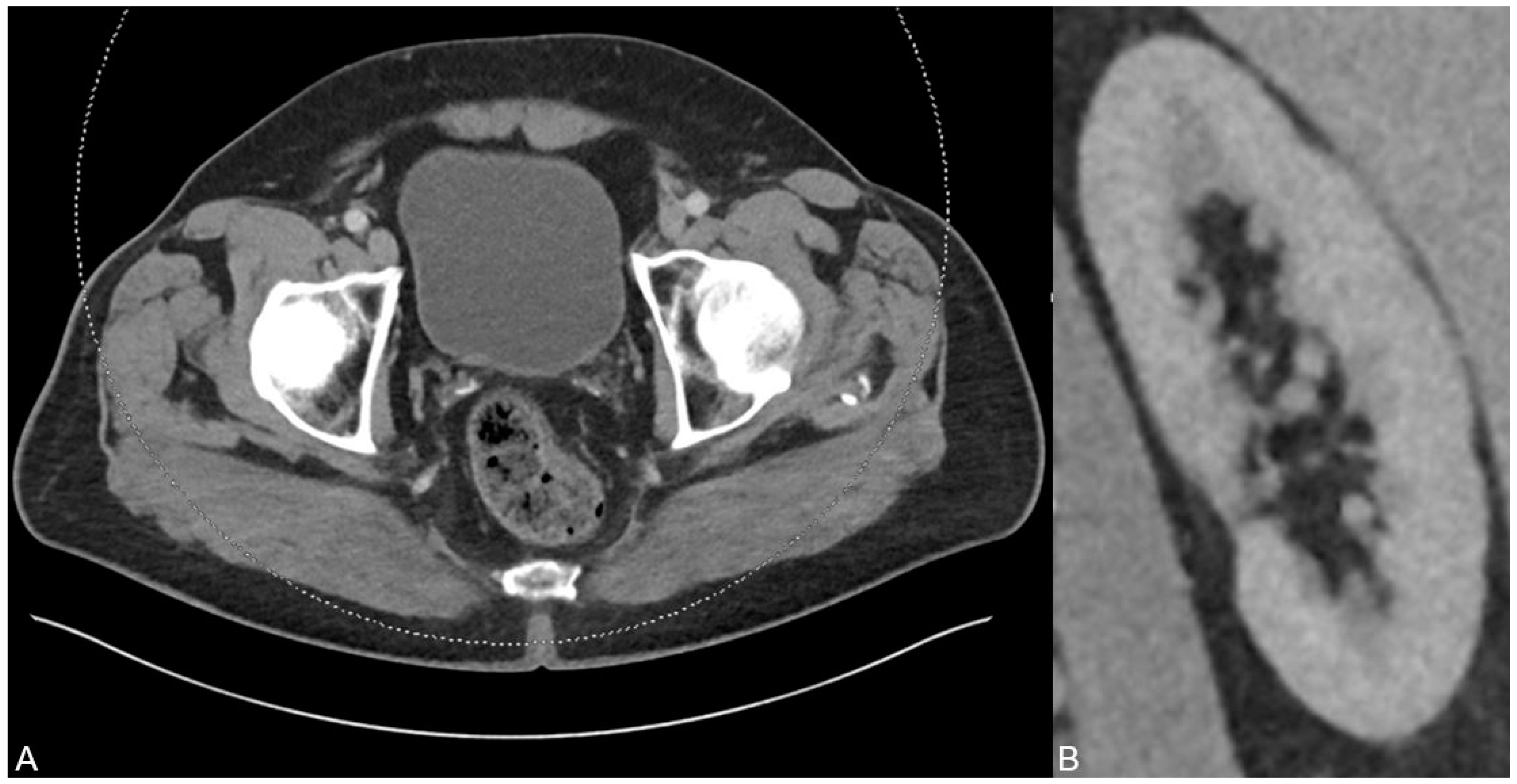 Diagnostics Free FullText Diagnosis of Uric AcidBased Urine