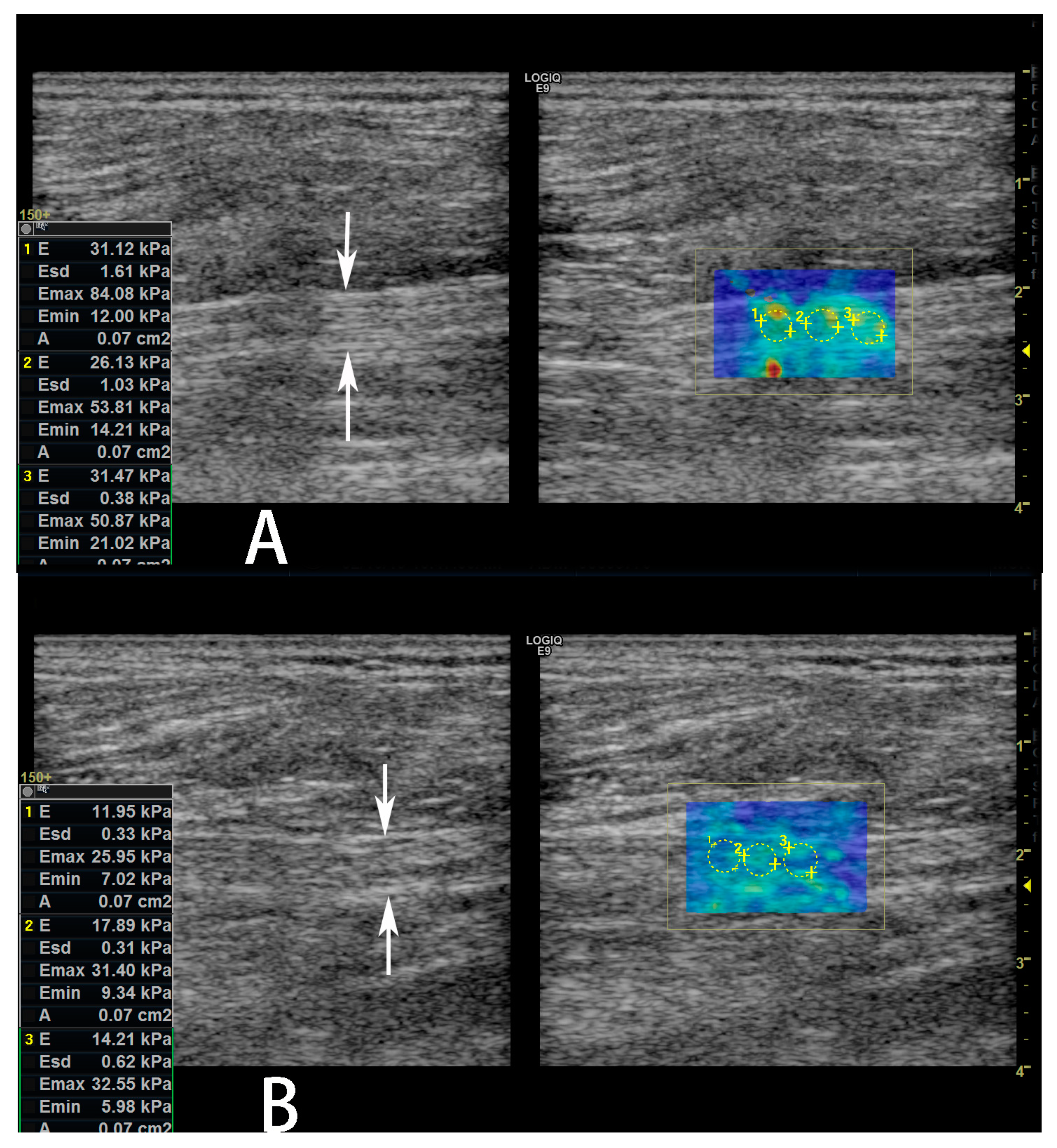 Diagnostics 13 00547 g003