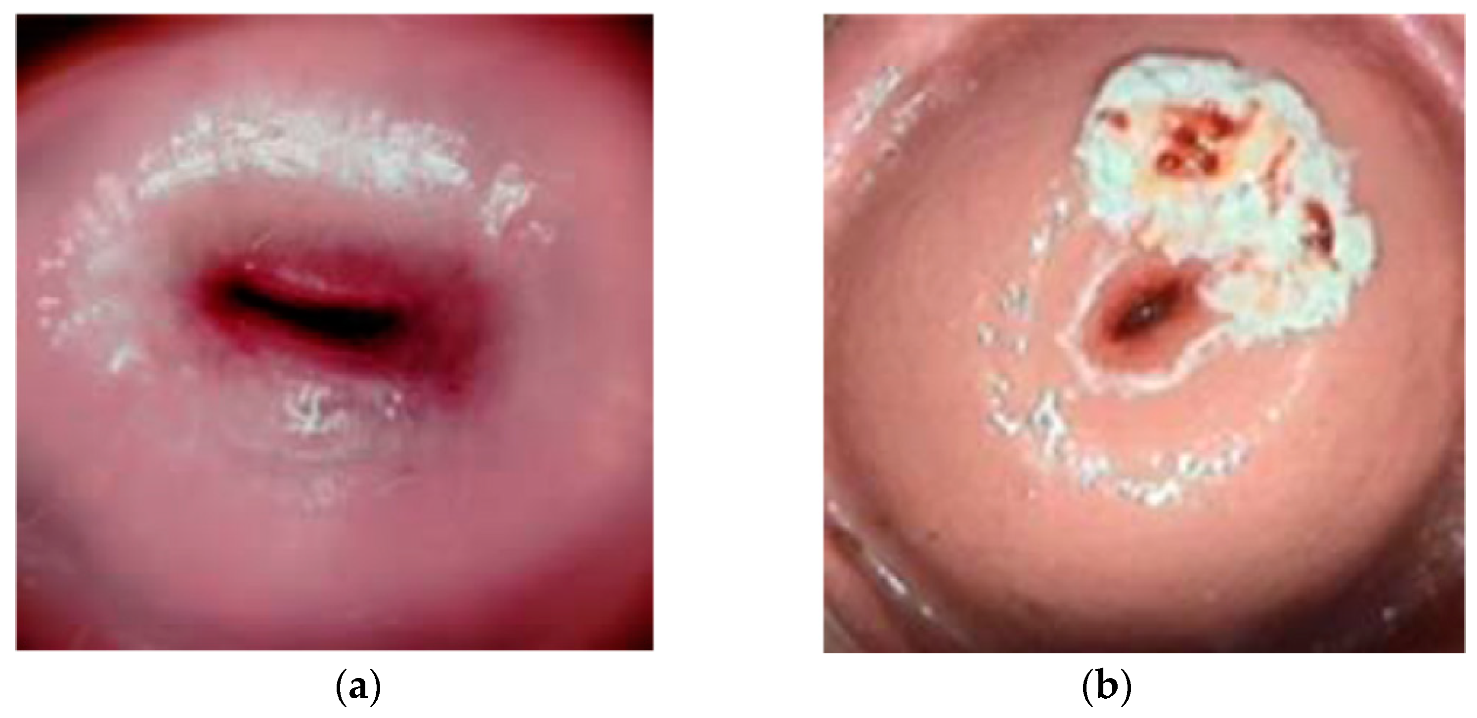 Diagnostics 13 00548 g001