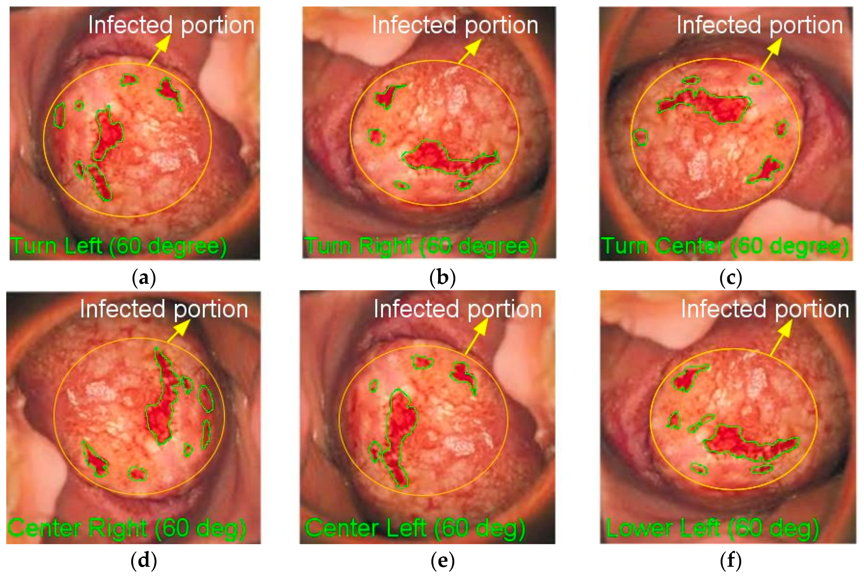 Diagnostics 13 00548 g003