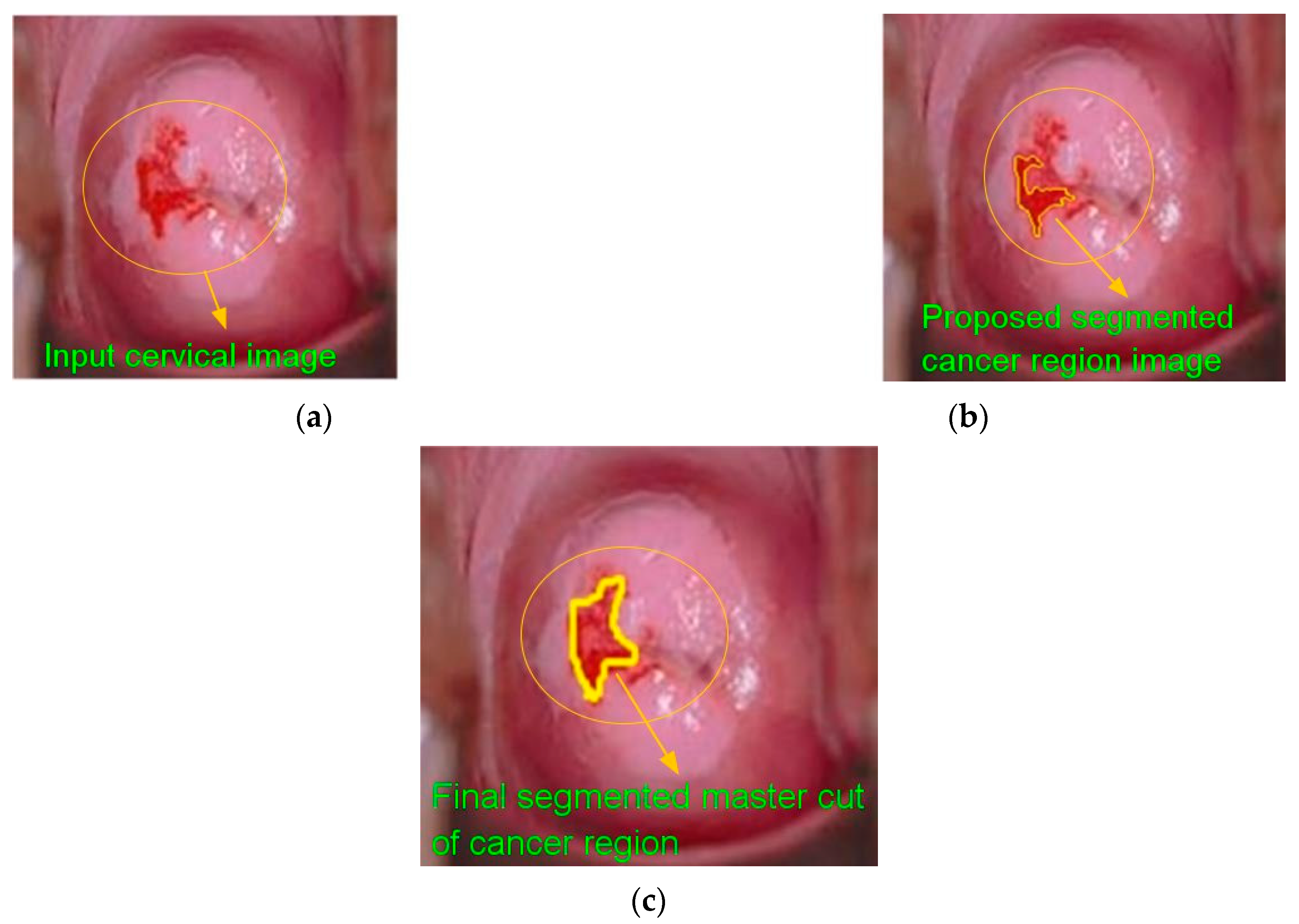 Diagnostics 13 00548 g008
