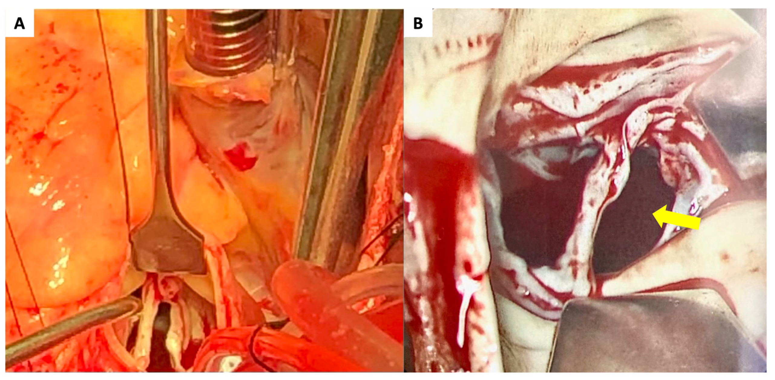 Diagnostics 13 00549 g002 Diagnostics 13 00549 g002