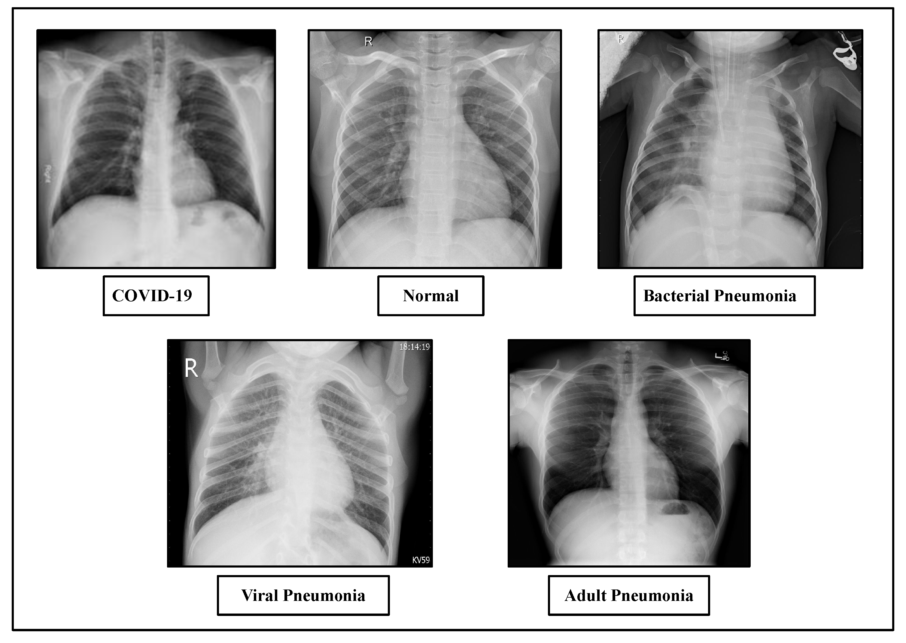 Diagnostics Free Full Text DTLCx An Improved ResNet Architecture diagnostics-free-full-text-dtlcx-an-improved-resnet-architecture