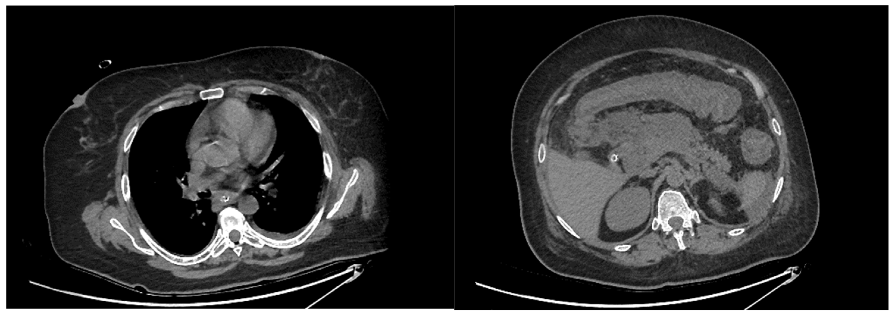 Diagnostics 13 00562 g001