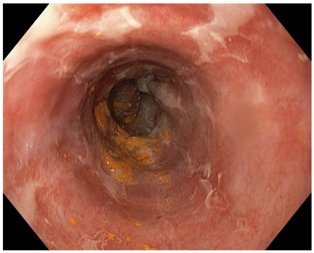 Diagnostics 13 00562 g004