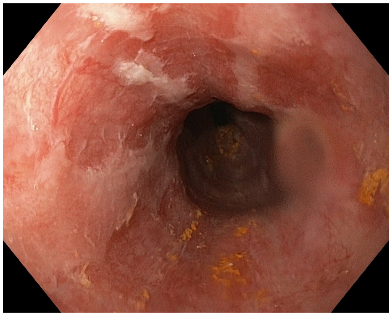 Diagnostics 13 00562 g005